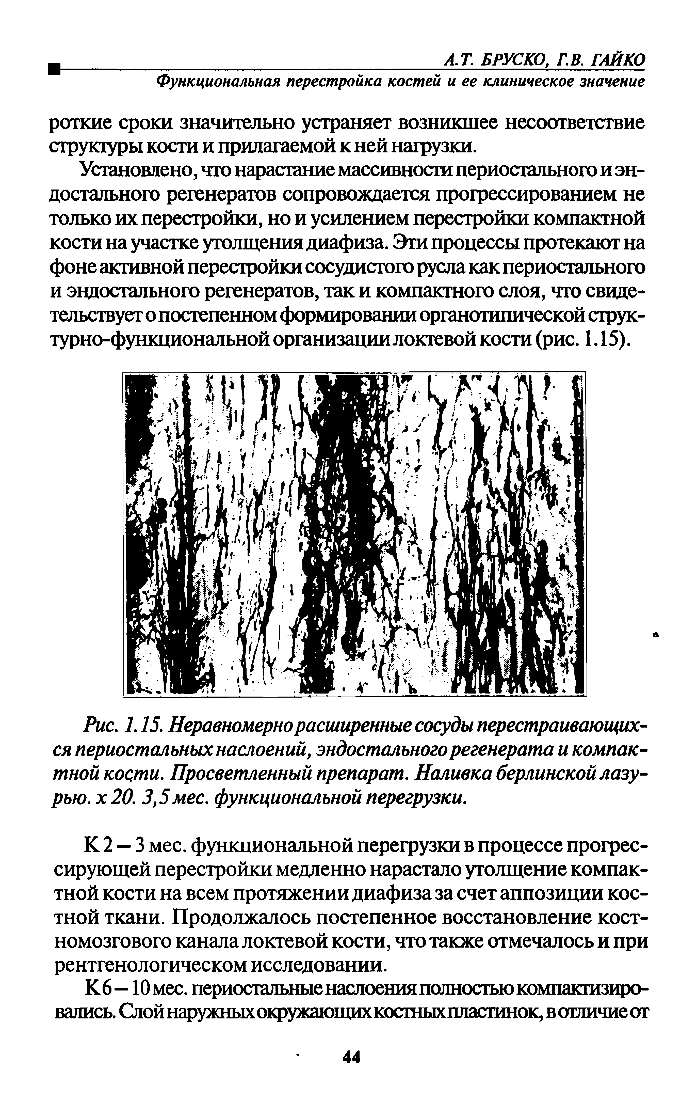 Рис. 1.15. Неравномерно расширенные сосуды перестраивающихся периостальных наслоений, эндостального регенерата и компактной кости. Просветленный препарат. Наливка берлинской лазурью. х 20. 3,5мес. функциональной перегрузки.