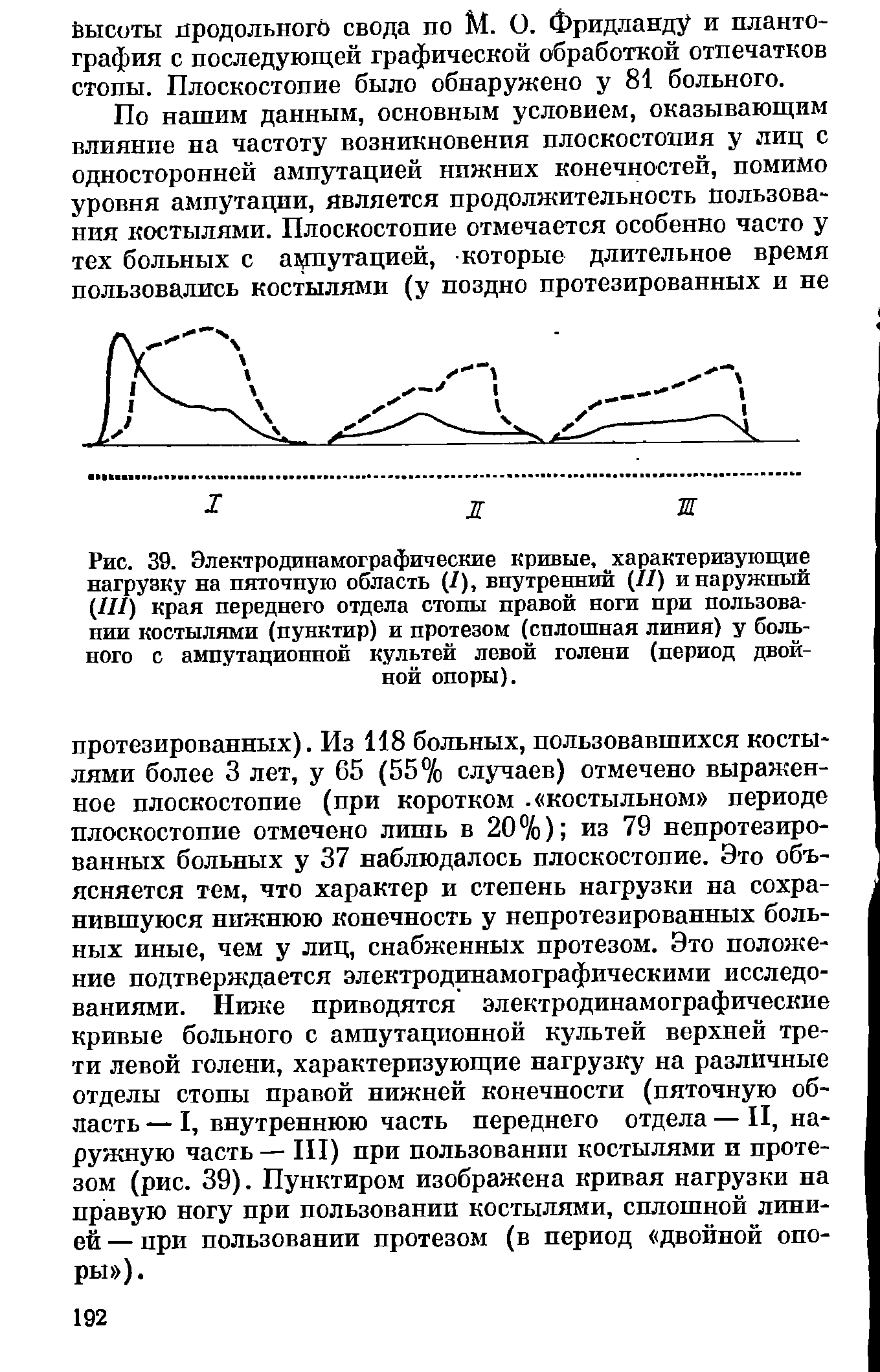 Рис. 39. Электродинамографические кривые, характеризующие нагрузку на пяточную область (/), внутренний (11) и наружный (111) края переднего отдела стопы правой ноги при пользовании костылями (пунктир) и протезом (сплошная линия) у больного с ампутационной культей левой голени (период двойной опоры).