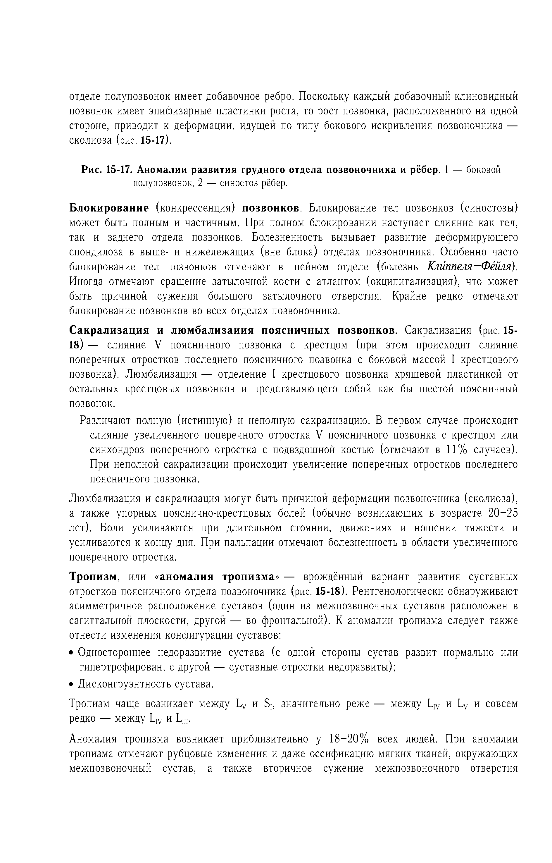 Рис. 15-17. Аномалии развития грудного отдела позвоночника и рёбер. 1 — боковой полупозвонок, 2 — синостоз рёбер.