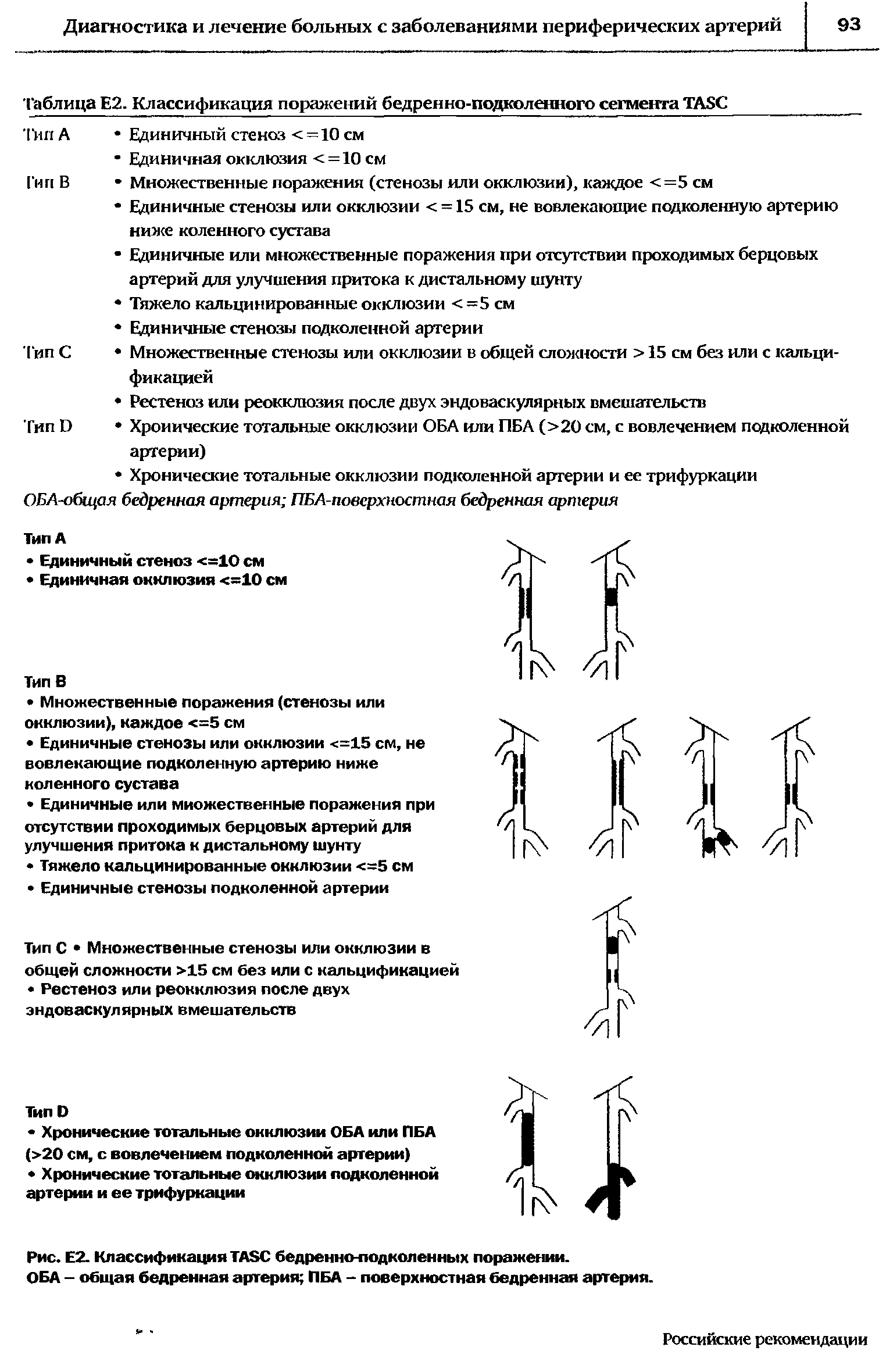 Таблица Е2. Классификация поражений бедренно-подколенного сегмента TA.SC...