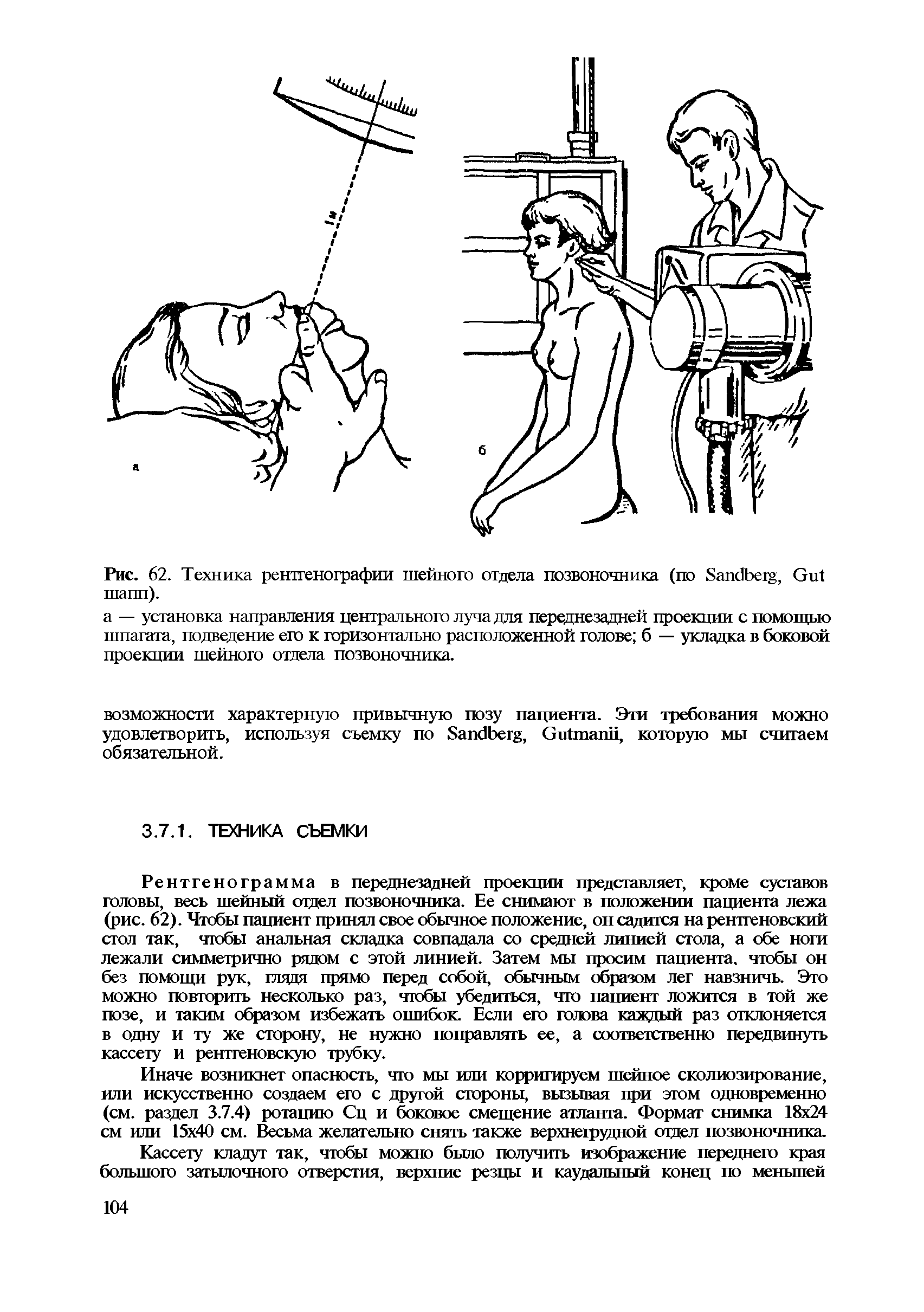 Рис. 62. Техника рентгенографии шейного отдела позвоночника (по S , G шапп).