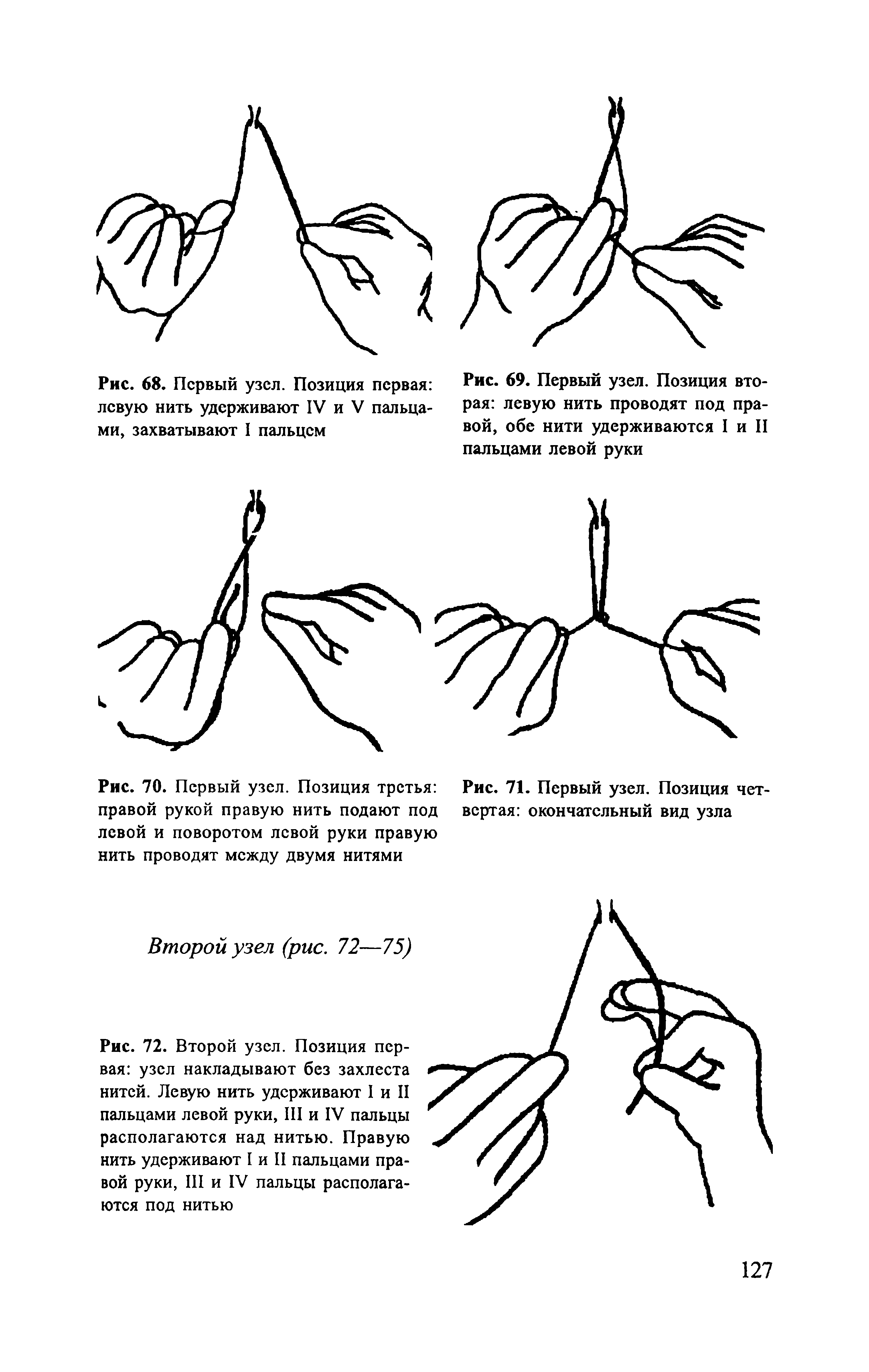 Рис. 69. Первый узел. Позиция вторая левую нить проводят под правой, обе нити удерживаются I и II пальцами левой руки...