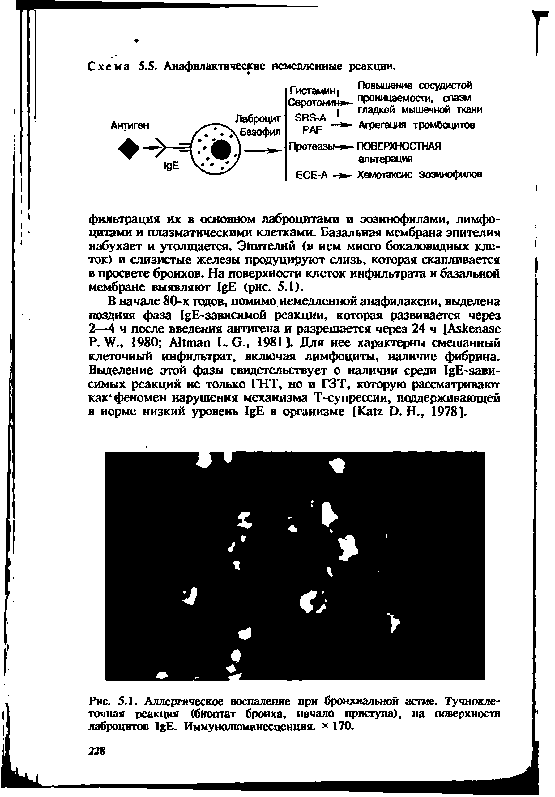 Рис. 5.1. Аллергическое воспаление при бронхиальной астме. Тучноклеточная реакция (бйоптат бронха, начало приступа), на поверхности лаброцитов I E. Иммунолюминесценция. 170.