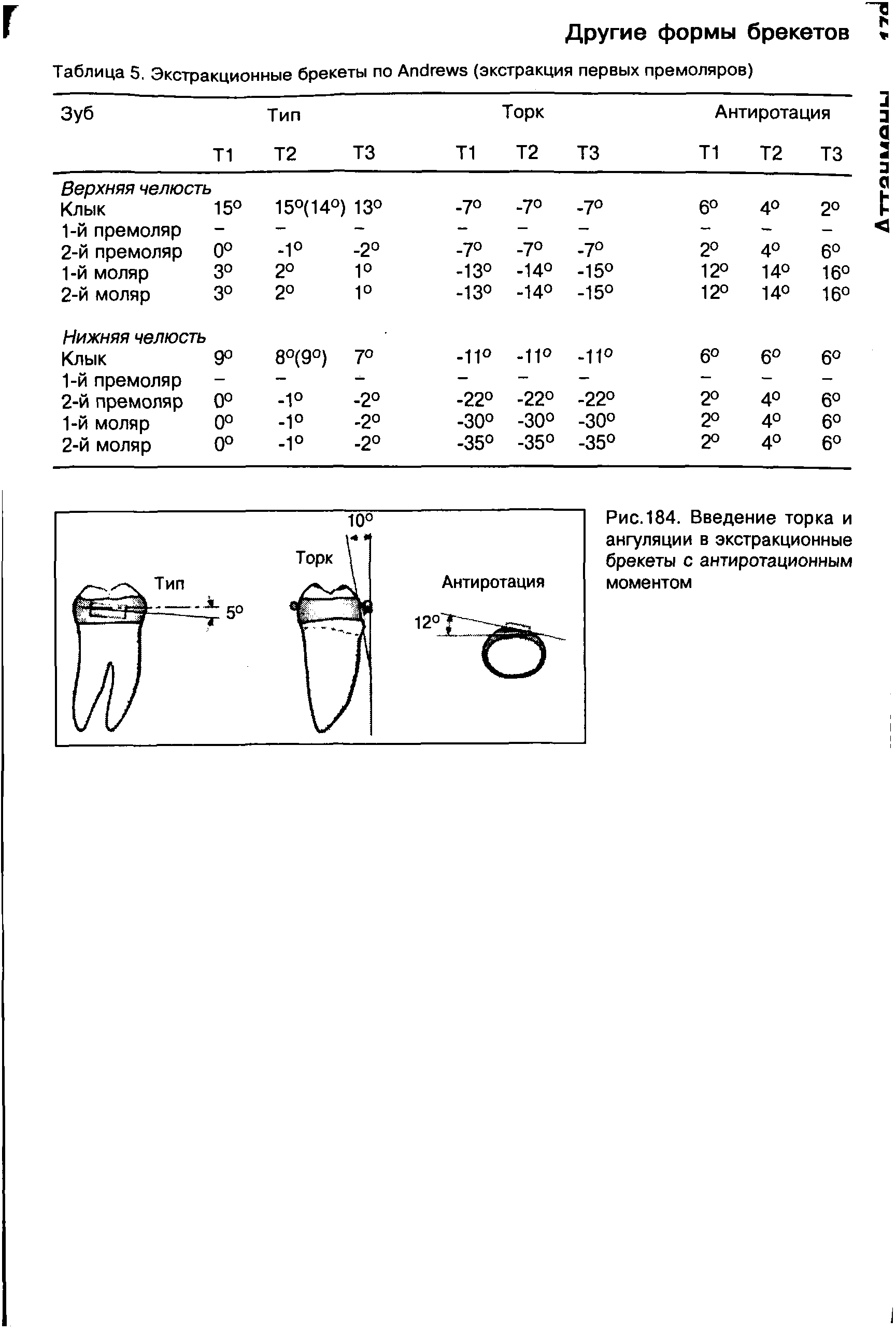 Рис. 184. Введение торка и ангуляции в экстракционные брекеты с антиротационным моментом...