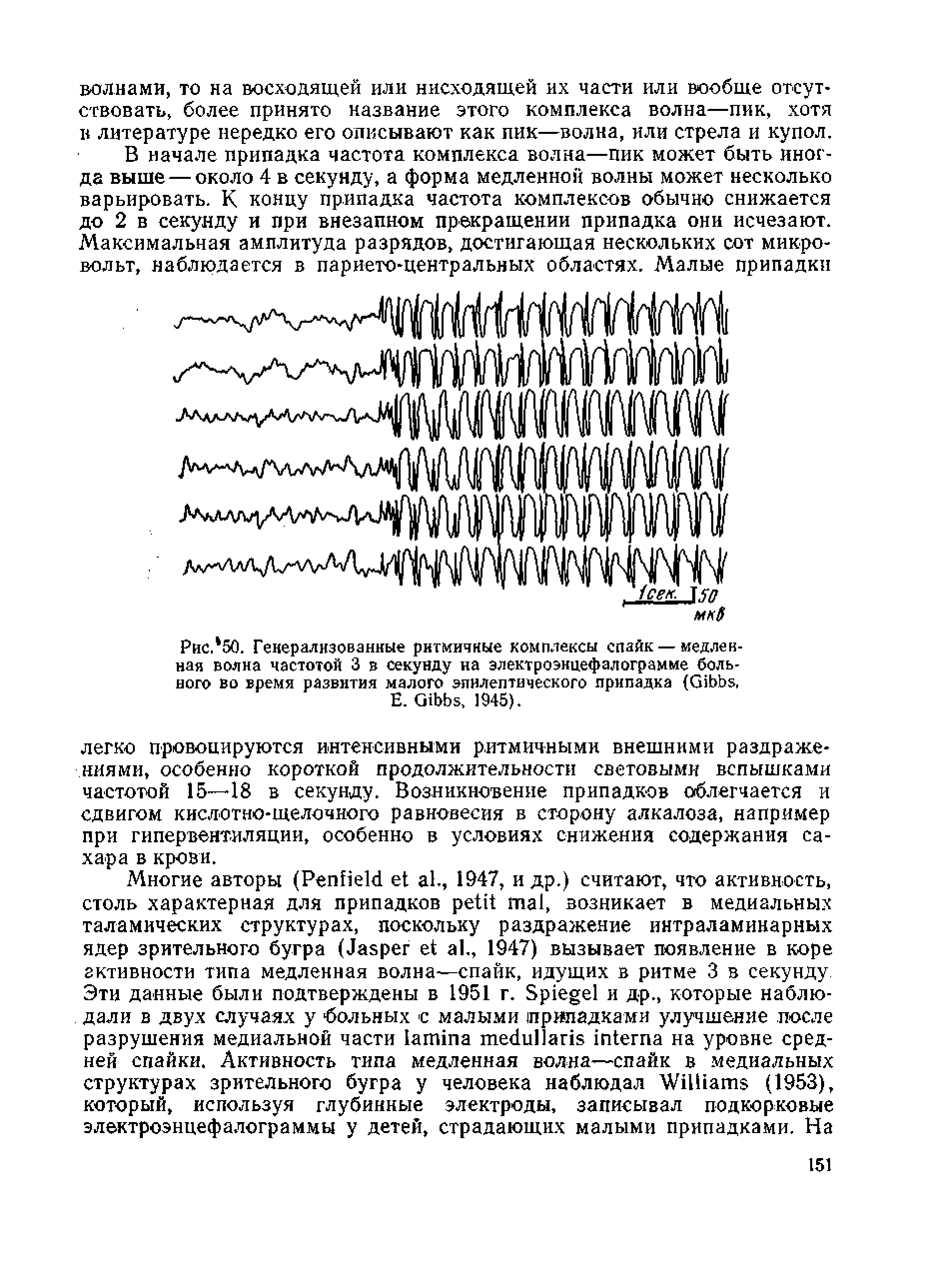 Рис. 50. Генерализованные ритмичные комплексы спайк — медленная волна частотой 3 в секунду на электроэнцефалограмме больного во время развития малого эпилептического припадка (G , Е. G , 1945).
