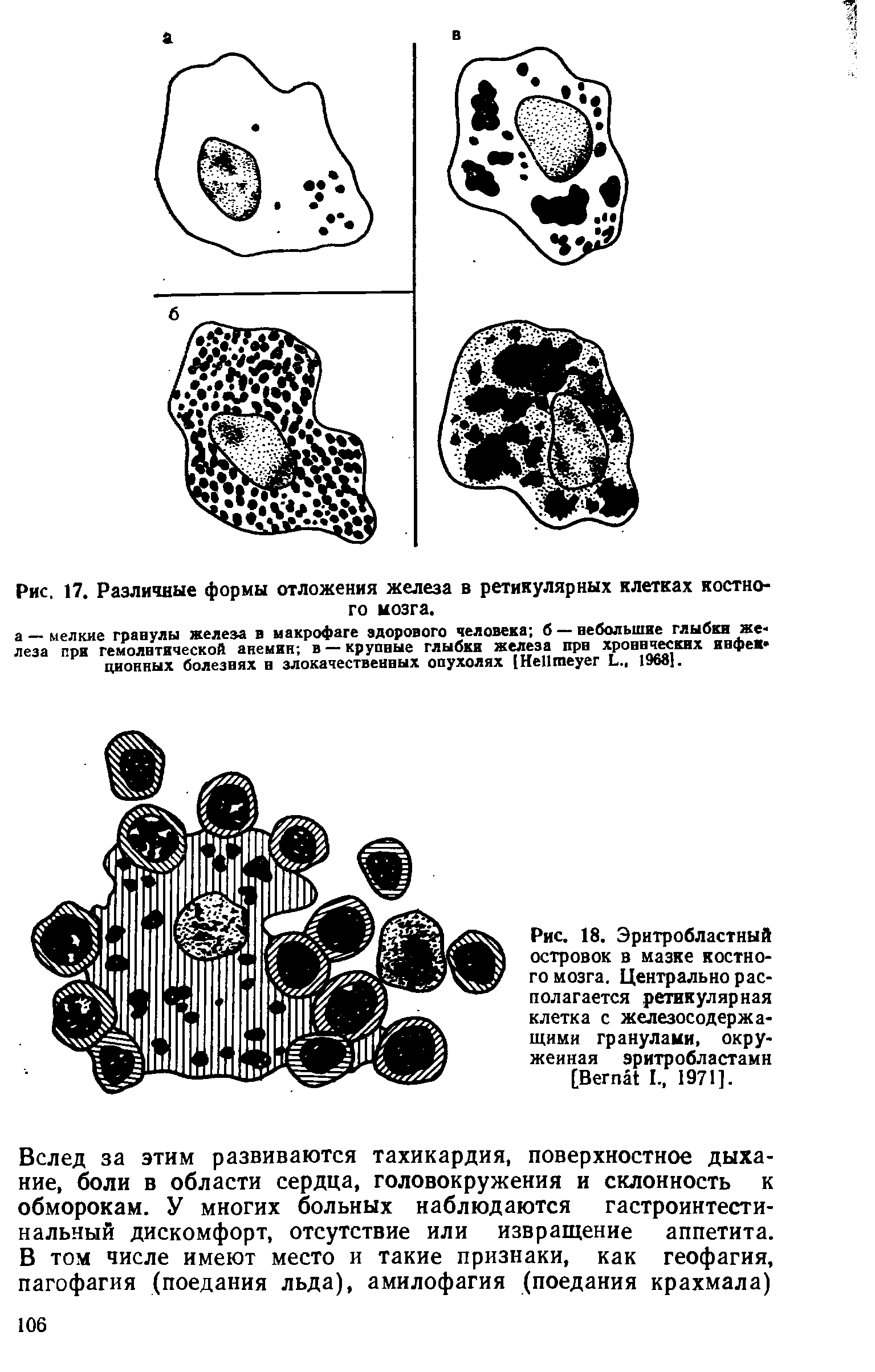 Рис. 18. Эритробластный островок в мазке костного мозга. Центрально располагается ретикулярная клетка с железосодержащими гранулами, окруженная эритробластами [B I., 1971].