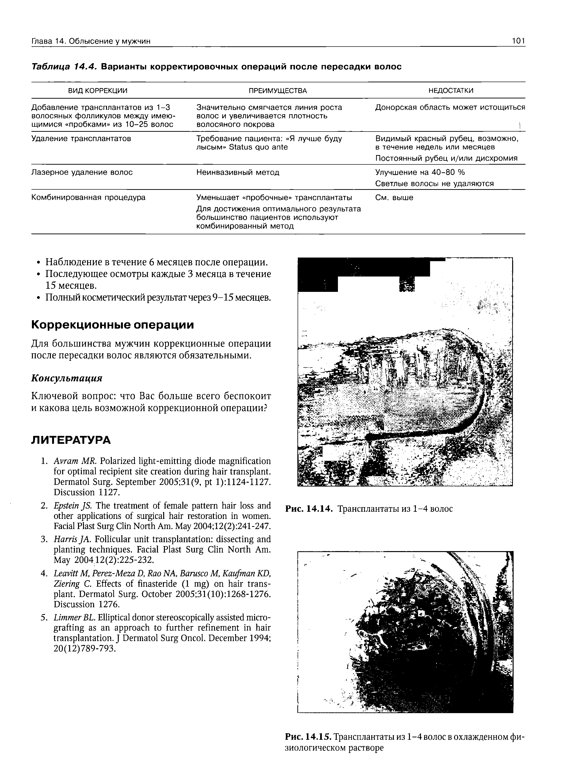 Таблица 14.4. Варианты корректировочных операций после пересадки волос ...