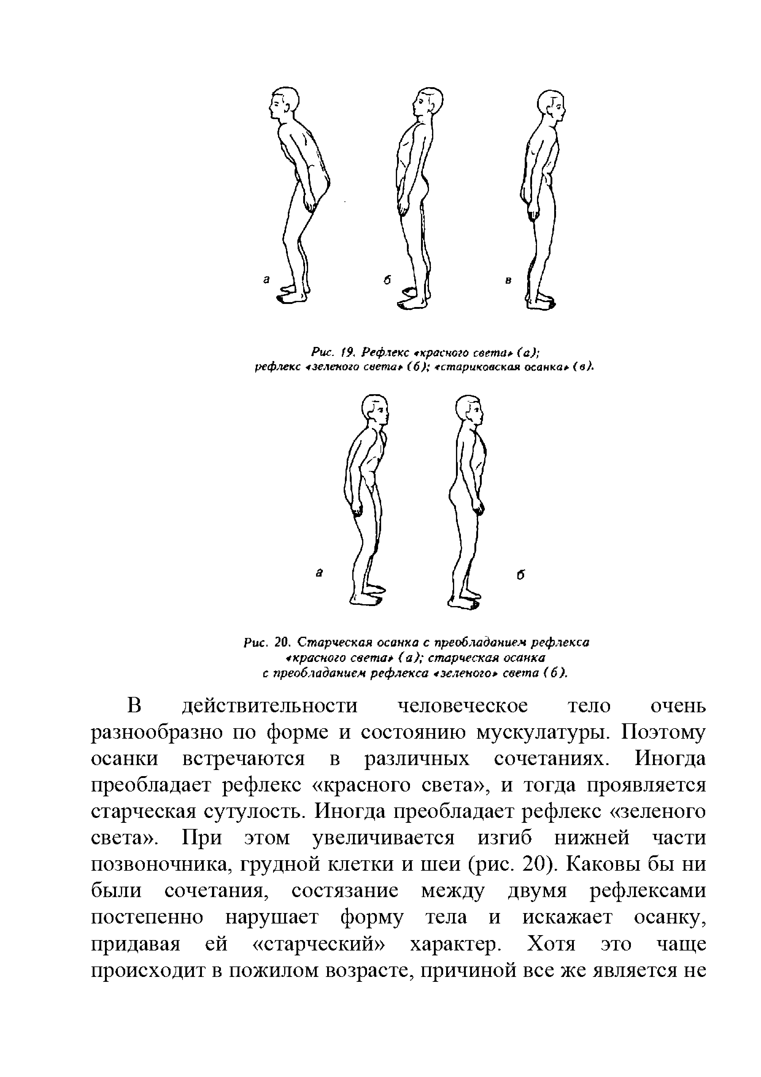Рис. 20. Старческая осанка с преобладанием рефлекса красного света (а) старческая осанка с преобладанием рефлекса зеленого света (б).