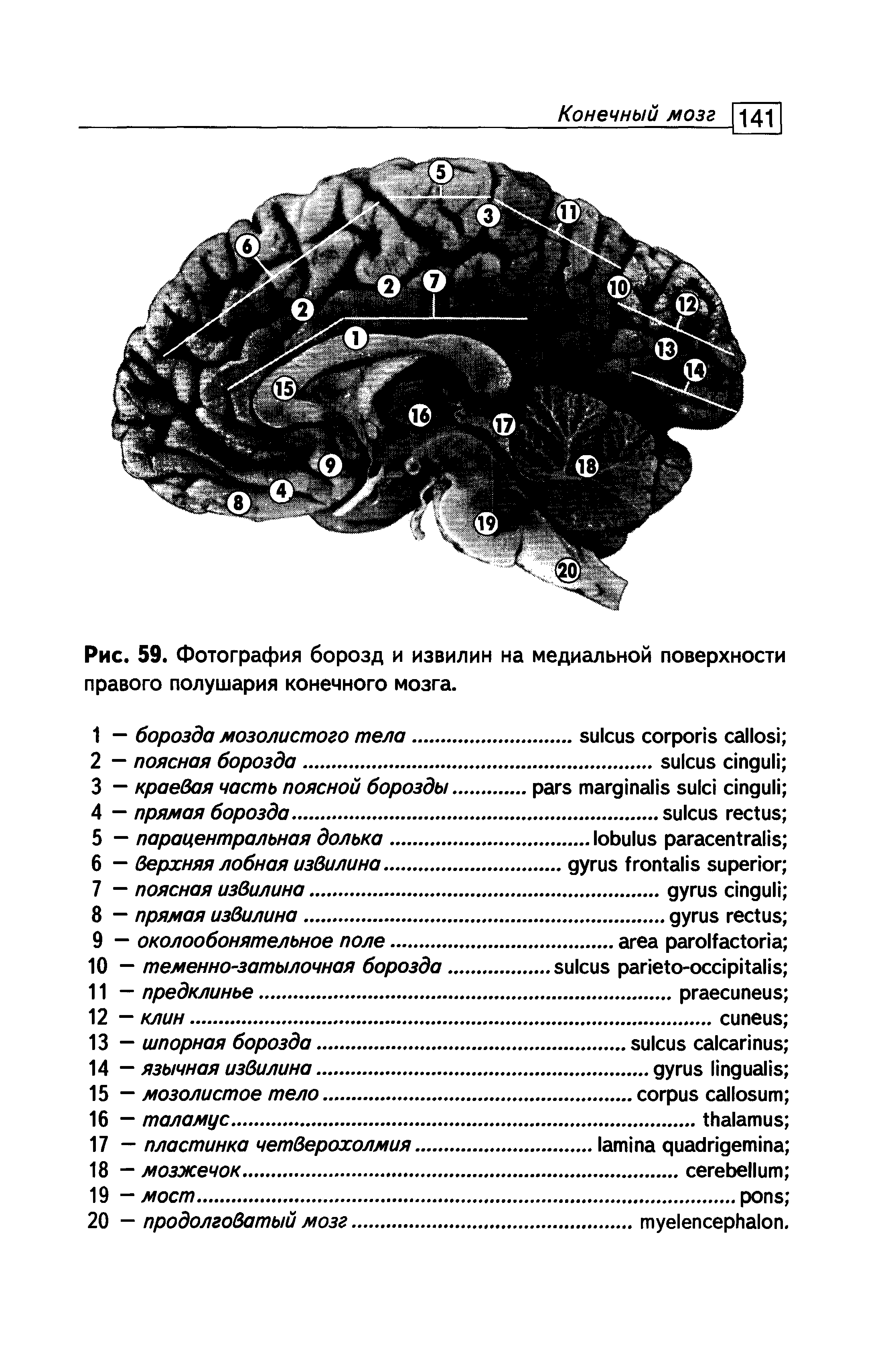Рис. 59. Фотография борозд и извилин на медиальной поверхности правого полушария конечного мозга.