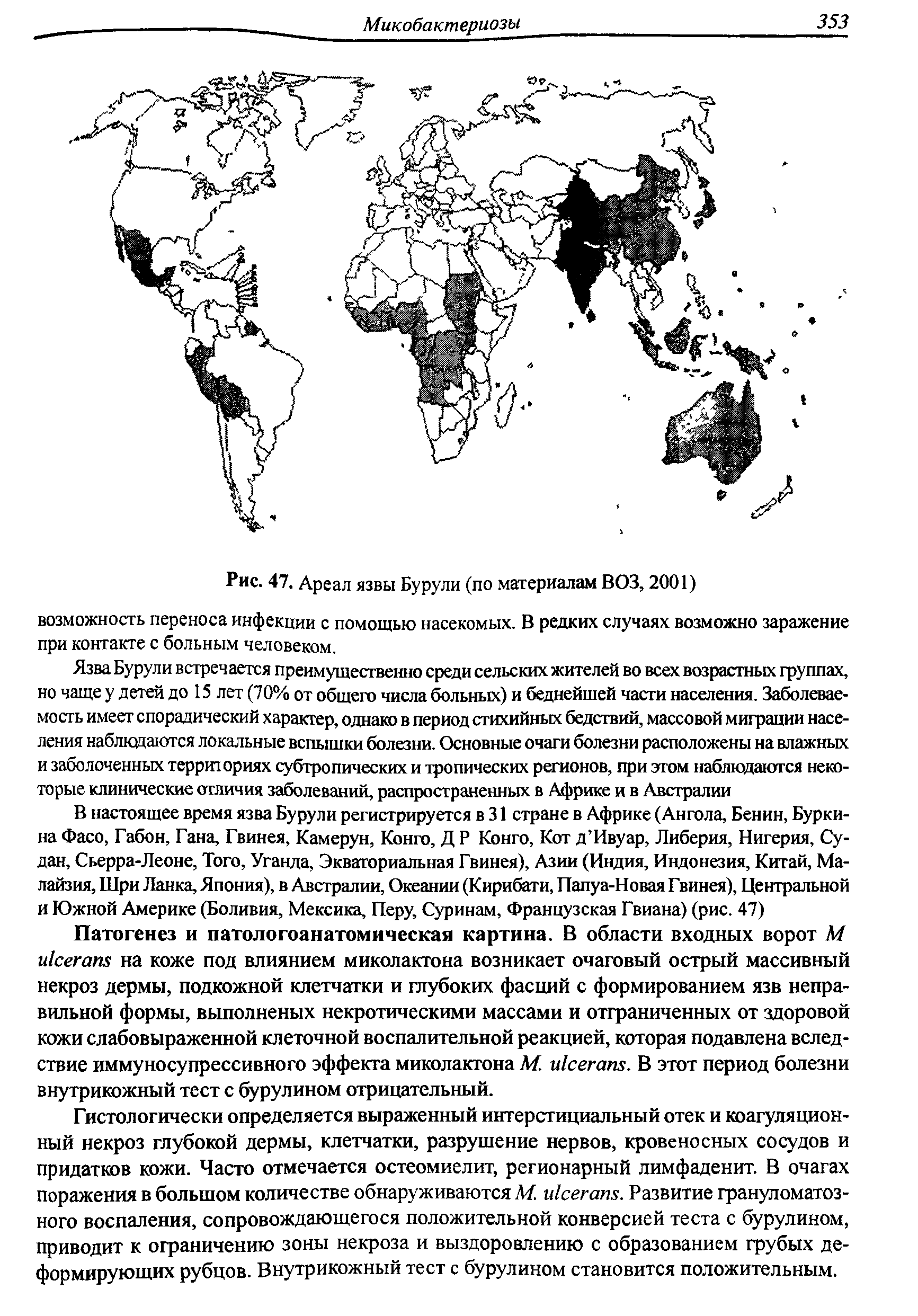 Рис. 47, Ареал язвы Бурули (по материалам ВОЗ, 2001) возможность переноса инфекции с помощью насекомых. В редких случаях возможно заражение при контакте с больным человеком.