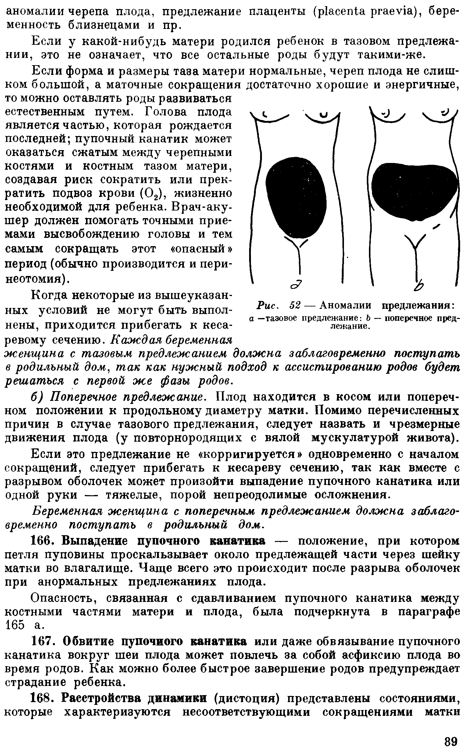 Рис. 52 — Аномалии предлежания а —тазовое предлежание Ь — поперечное предлежание.