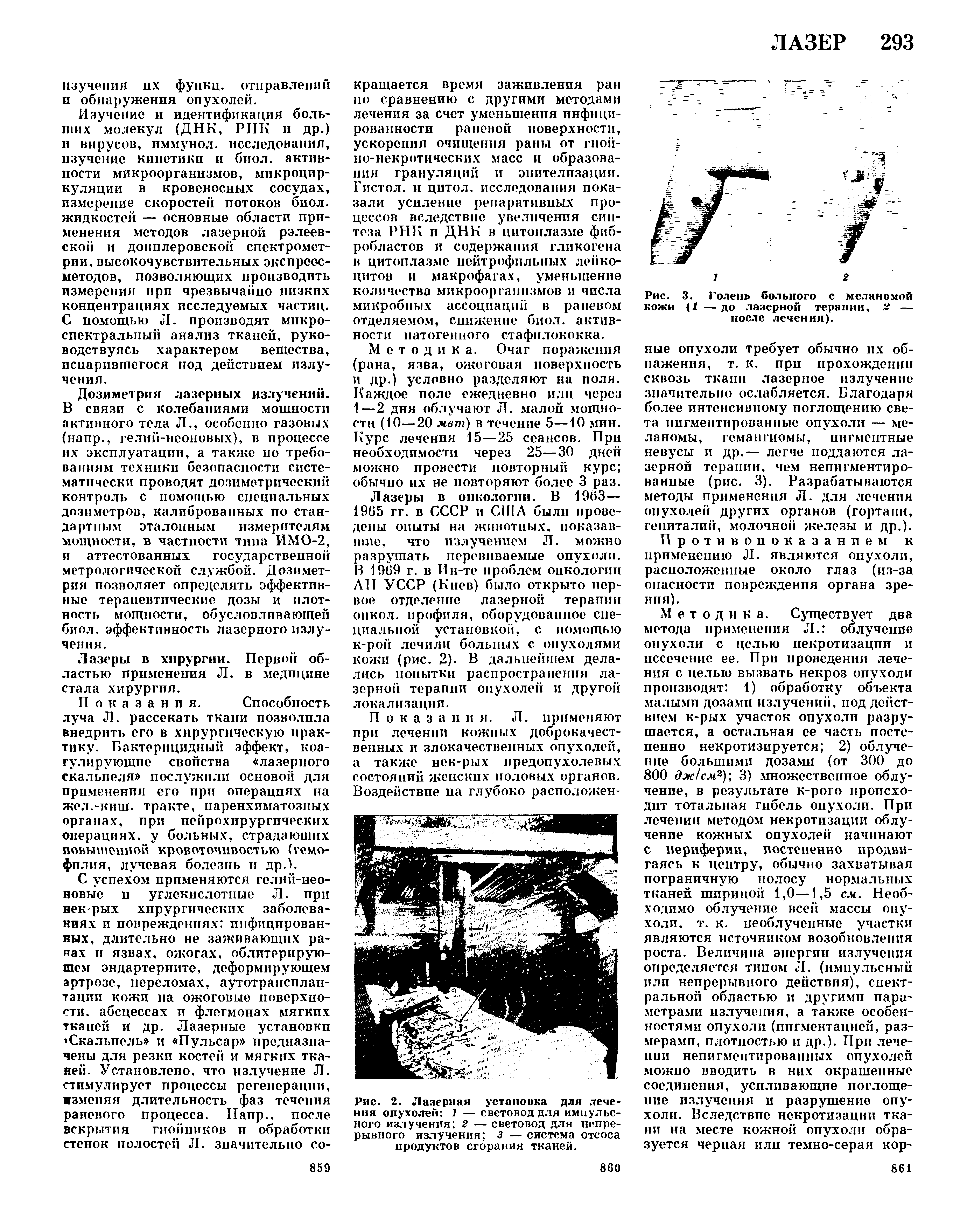 Рис. 2. Лазерная установка для лечения опухолей 1 —световод для импульсного излучения 2 — световод для непрерывного излучения 3 — система отсоса продуктов сгорания тканей.