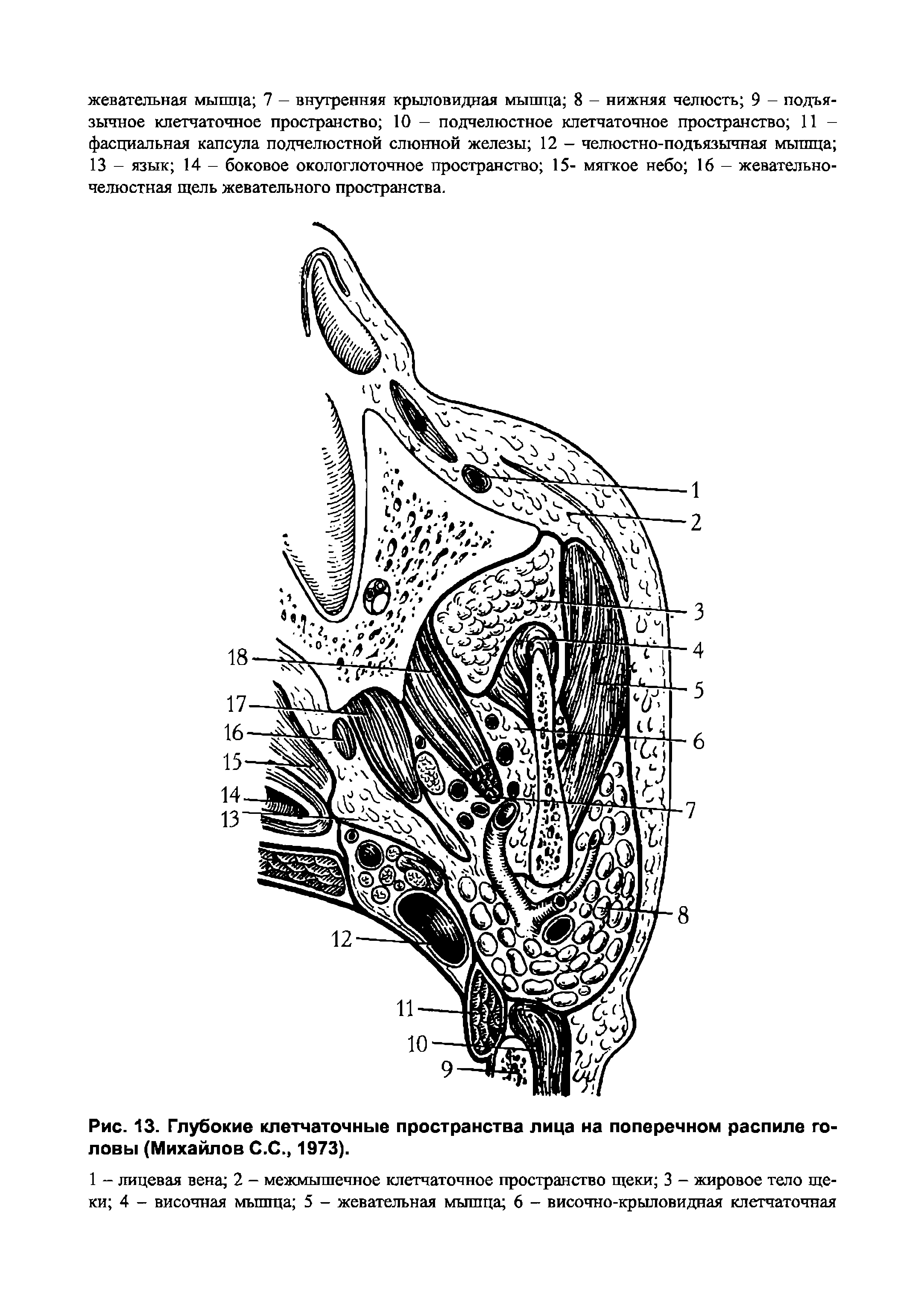 Рис. 13. Глубокие клетчаточные пространства лица на поперечном распиле головы (Михайлов С.С., 1973).