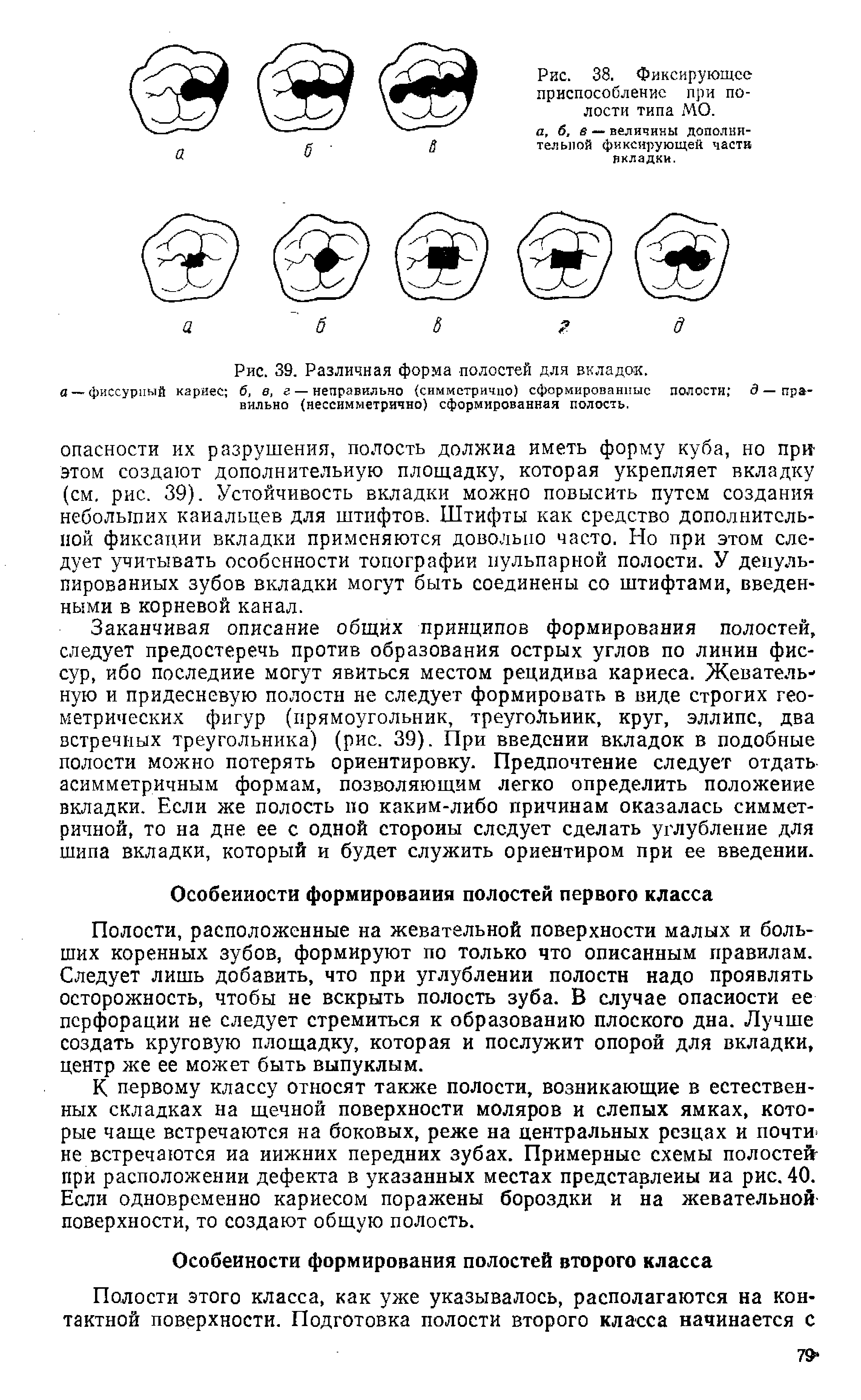 Рис. 39. Различная форма полостей для вкладок, а —фиссурный кариес б, в, г — неправильно (симметрично) сформированные полости —правильно (нессимметрично) сформированная полость.