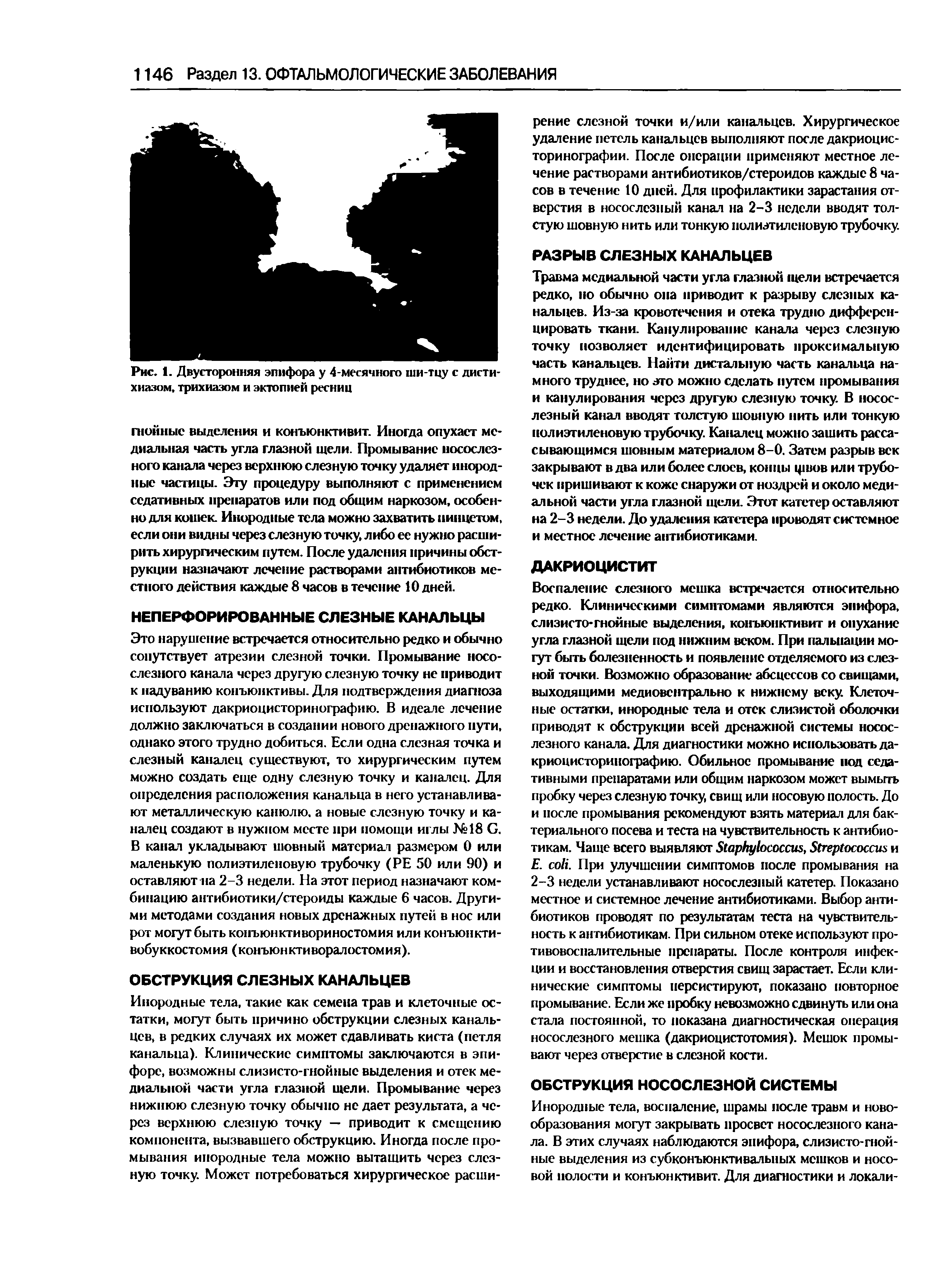 Рис. 1. Двусторонняя эпифора у 4-месячного ши-тцу с дисти-хиазом, трихиазом и эктопией ресниц...