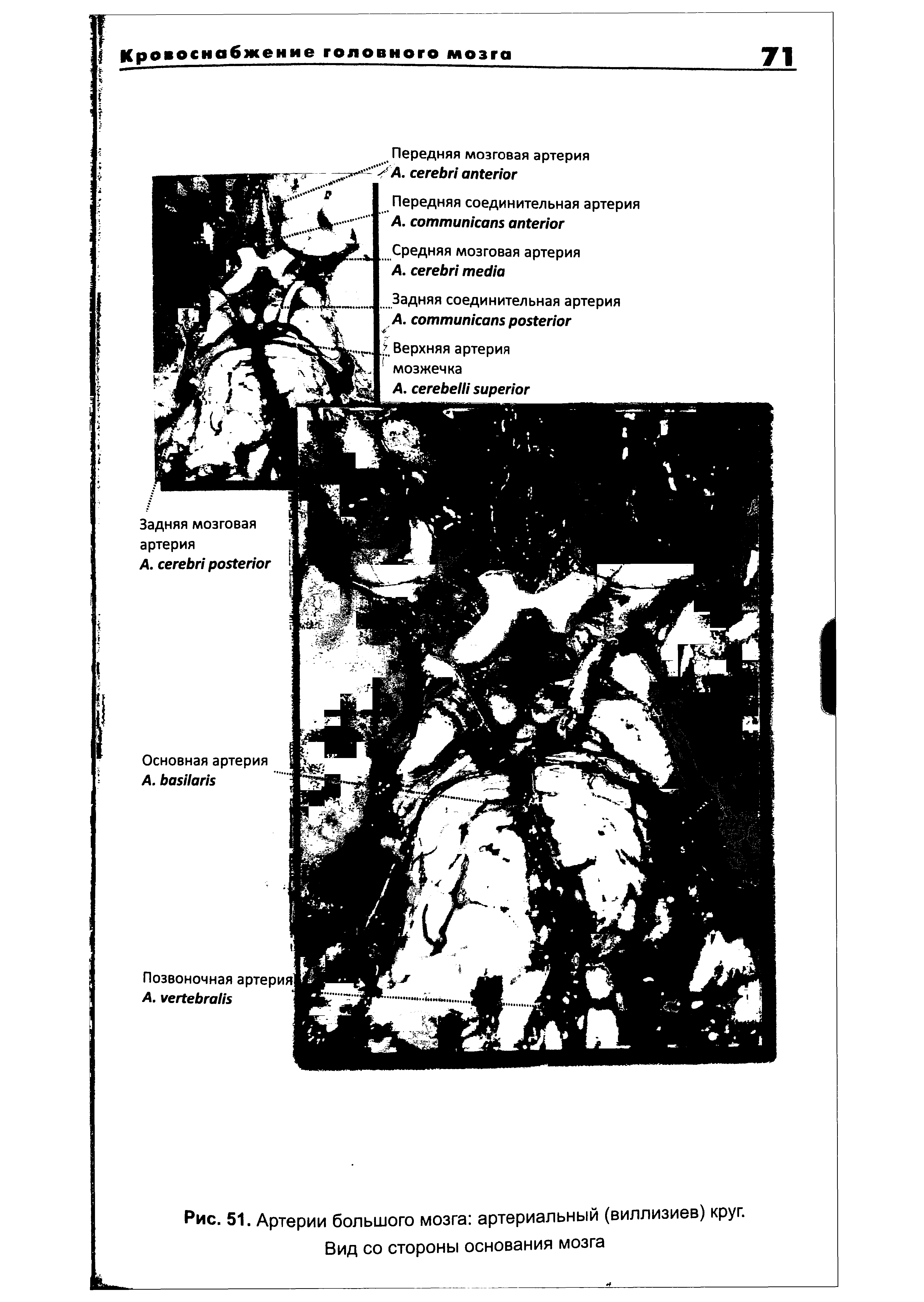 Рис. 51. Артерии большого мозга артериальный (виллизиев) круг. Вид со стороны основания мозга...