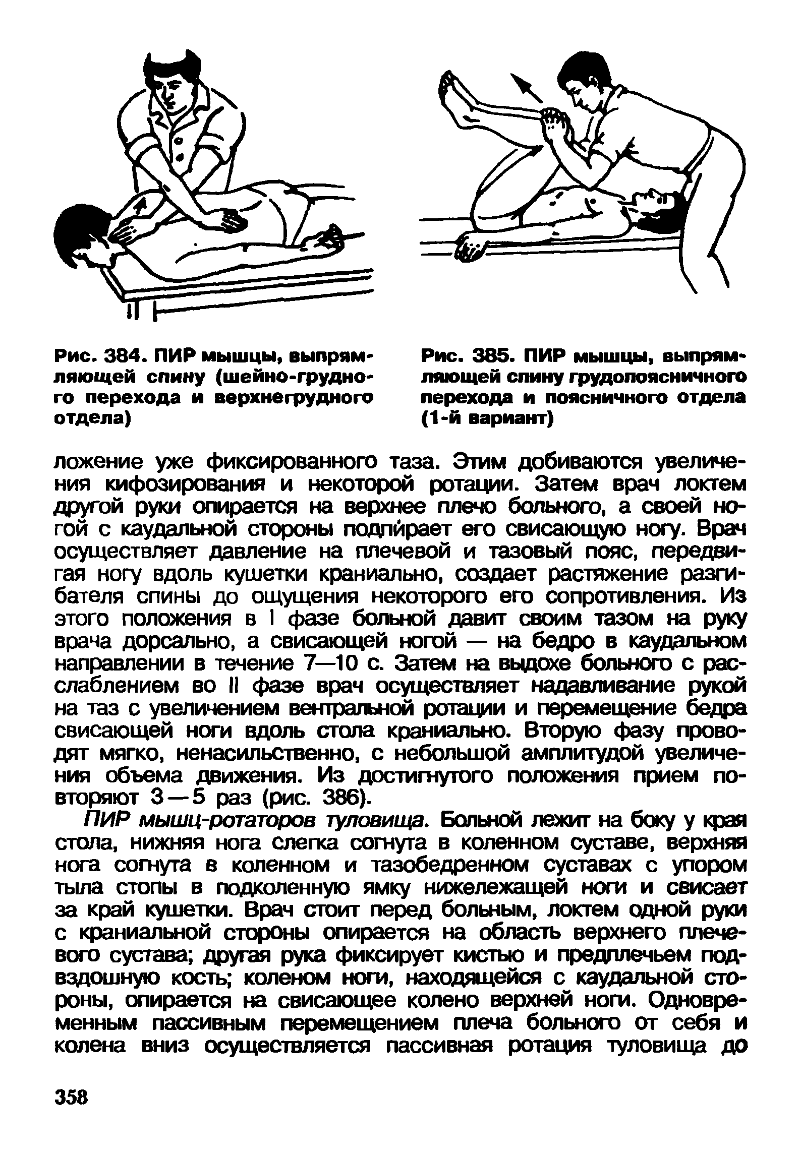 Рис. 385. ПИР мышцы, выпрямляющей спину грудопоясничного перехода и поясничного отдела (1-й вариант)...