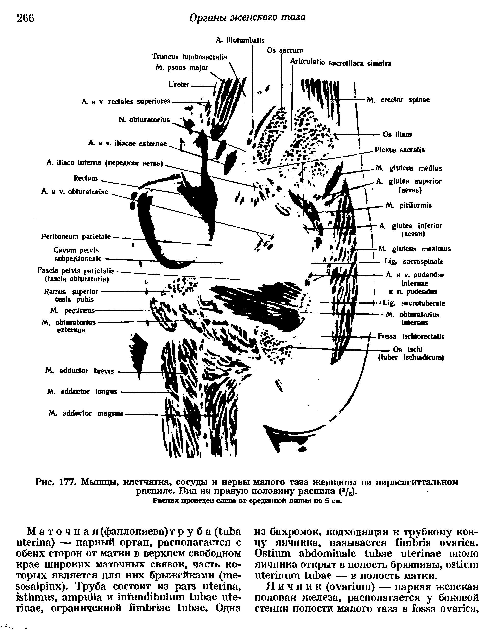Рис. 177. Мышцы, клетчатка, сосуды и нервы малого таза женщины на парасагиттальном распиле. Вид на правую половину распила (%).