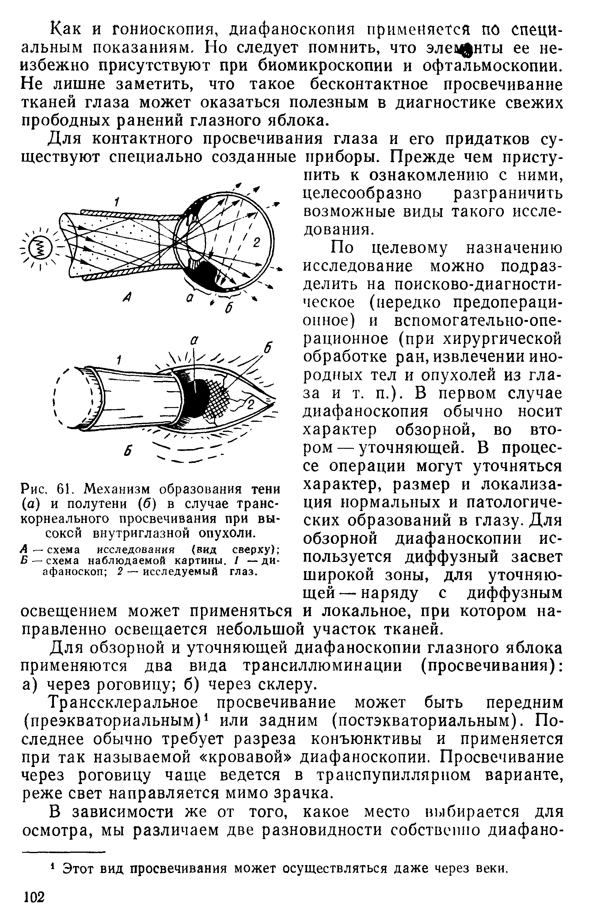 Рис. 61. Механизм образования тени (а) и полутени (б) в случае транскорнеального просвечивания при высокой внутриглазной опухоли.