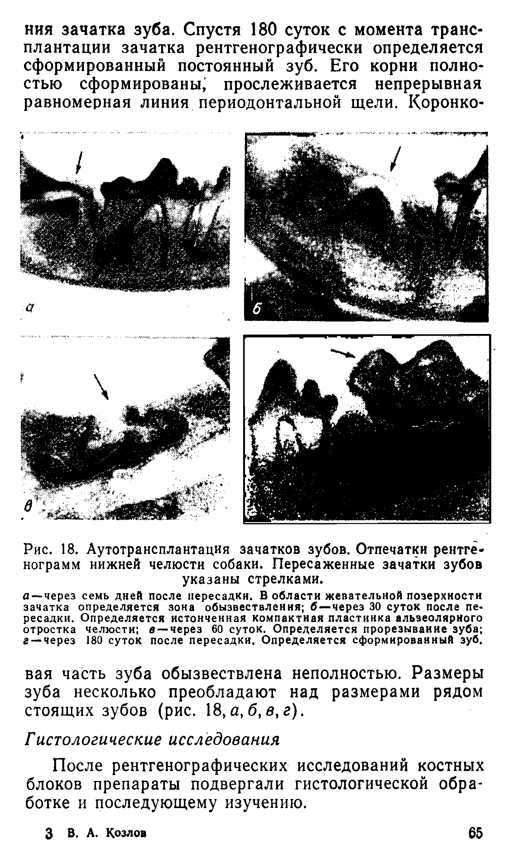 Рис. 18. Аутотрансплантация зачатков зубов. Отпечатки рентгенограмм нижней челюсти собаки. Пересаженные зачатки зубов указаны стрелками.