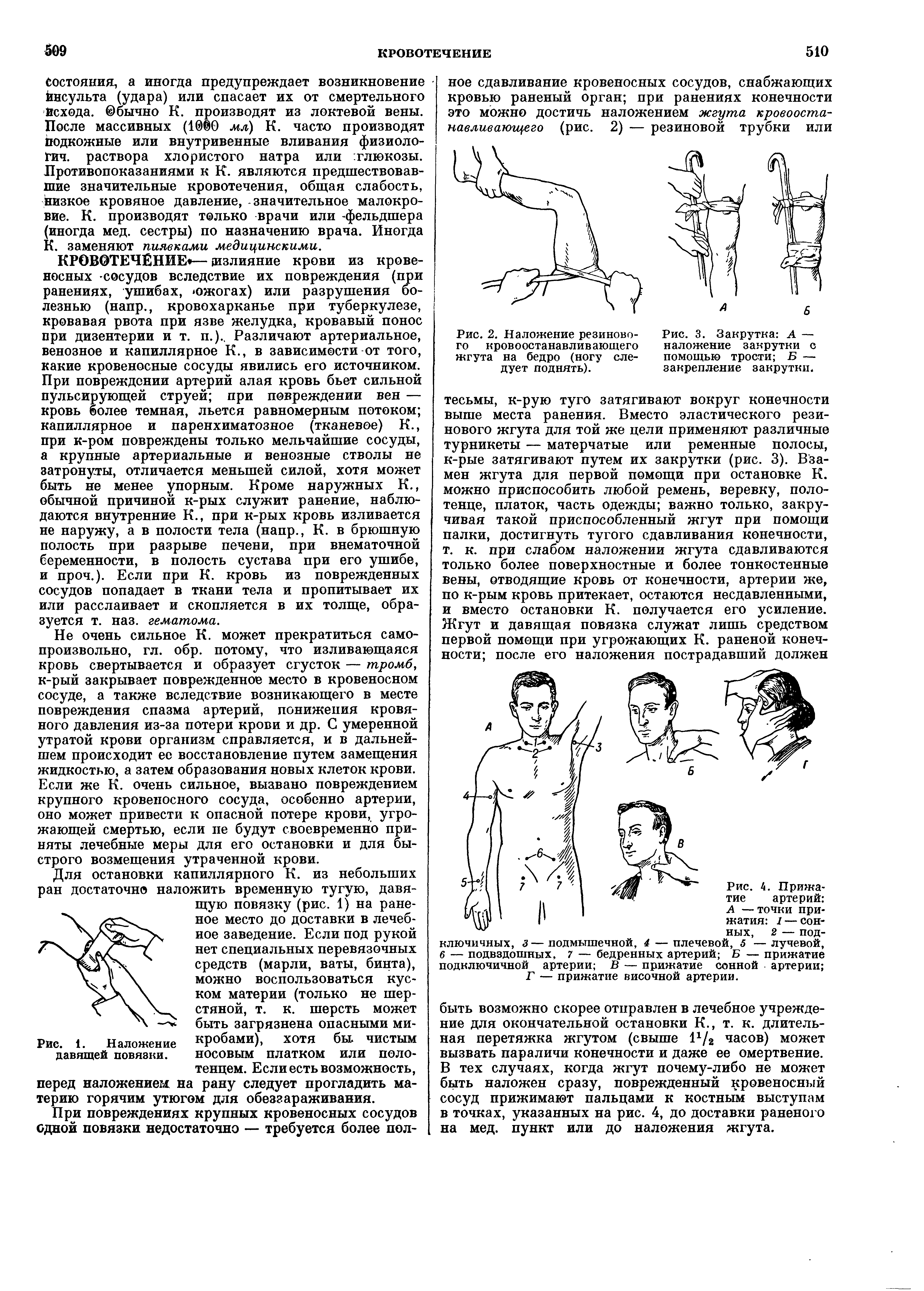 Рис. 4. Прижатие артерий Л —точки прижатия 1 — сонных, 2 — подключичных, з — подмышечной, 4 — плечевой, 5 — лучевой, 6 — подвздошных, 7 — бедренных артерий Б — прижатие подключичной артерии В — прижатие сонной артерии Г — прижатие височной артерии.