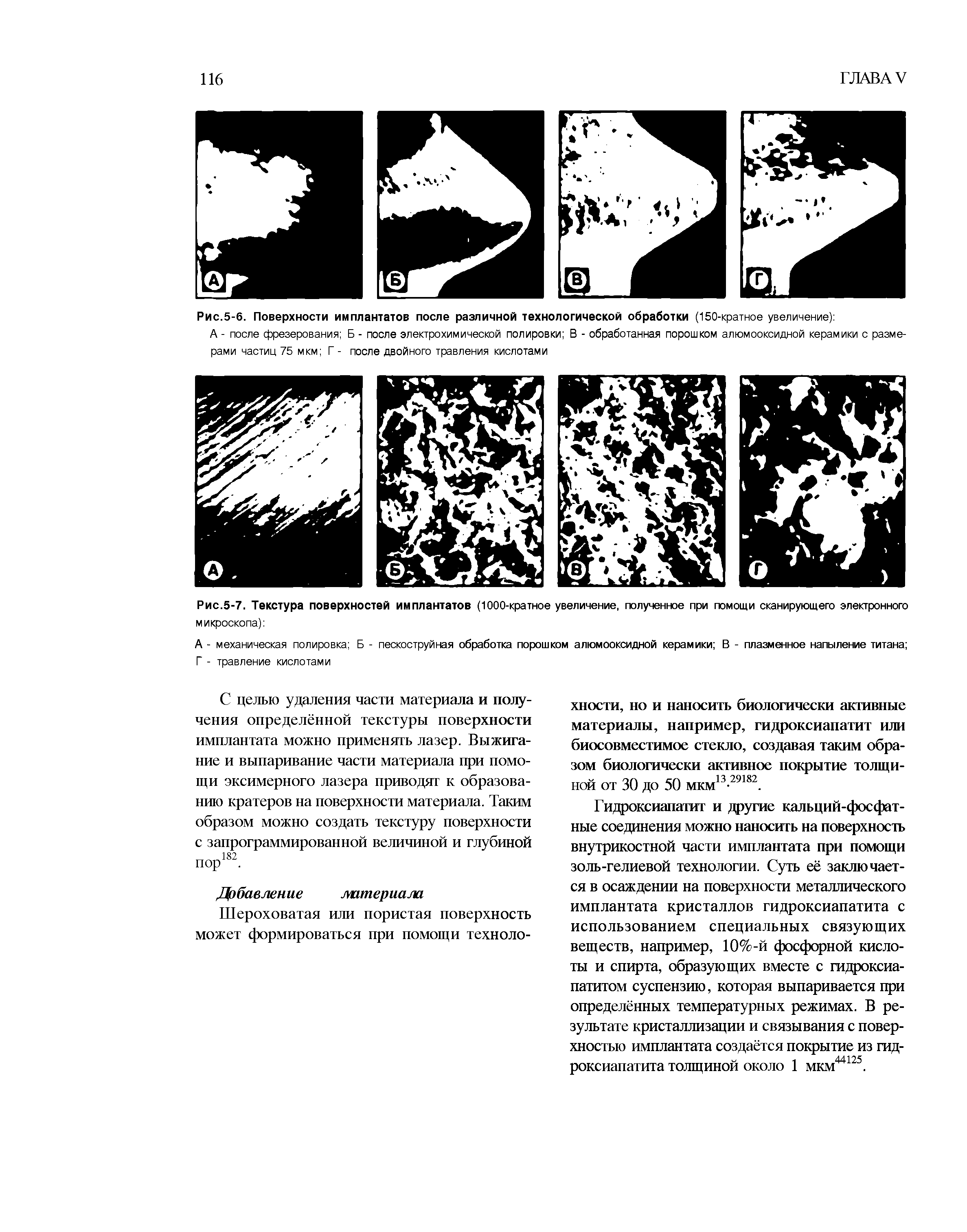 Рис.5-7. Текстура поверхностей имплантатов (1000-кратное увеличение, полученное при помощи сканирующего электронного микроскопа) ...