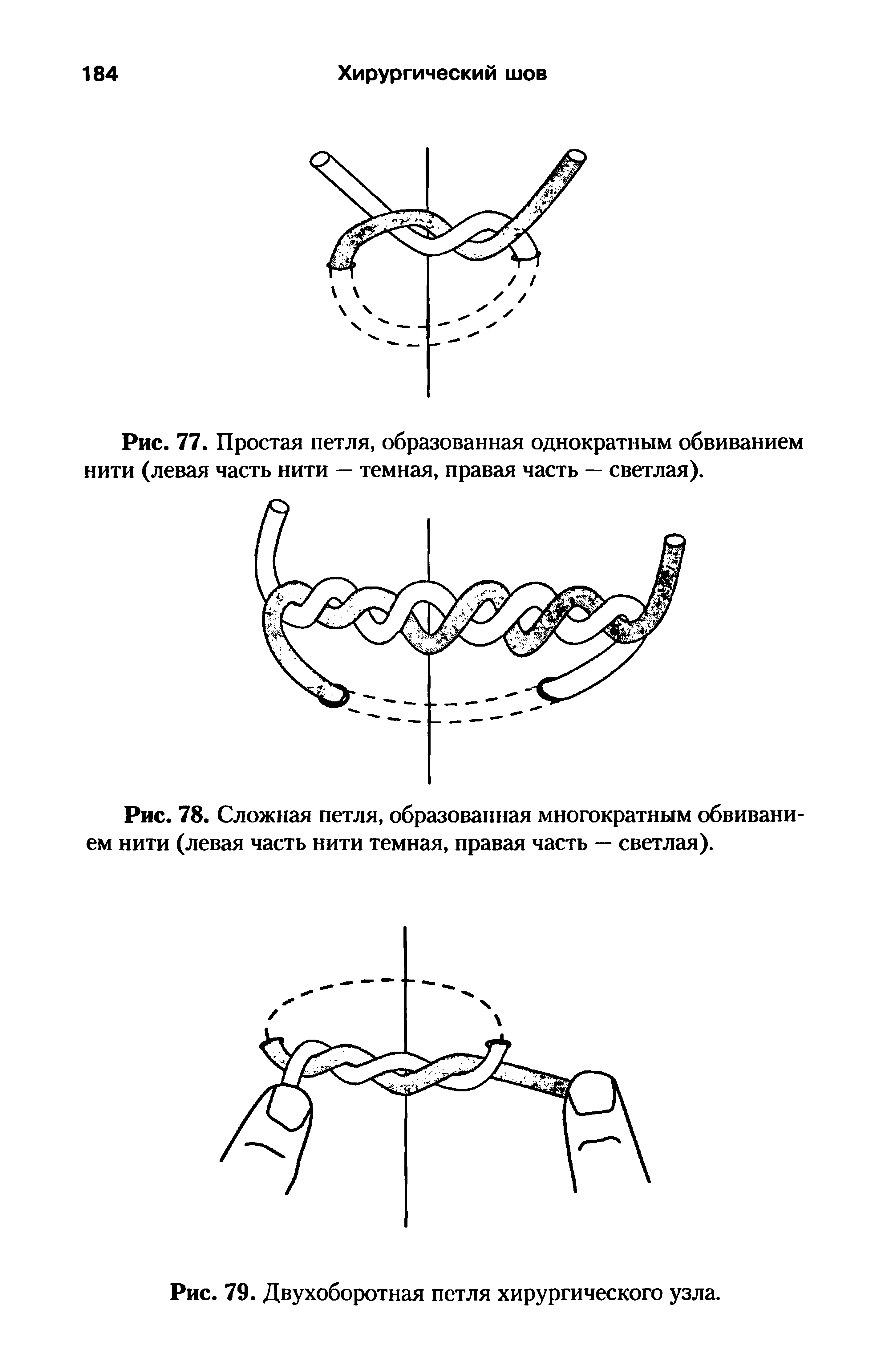 Рис. 77. Простая петля, образованная однократным обвиванием нити (левая часть нити — темная, правая часть — светлая).