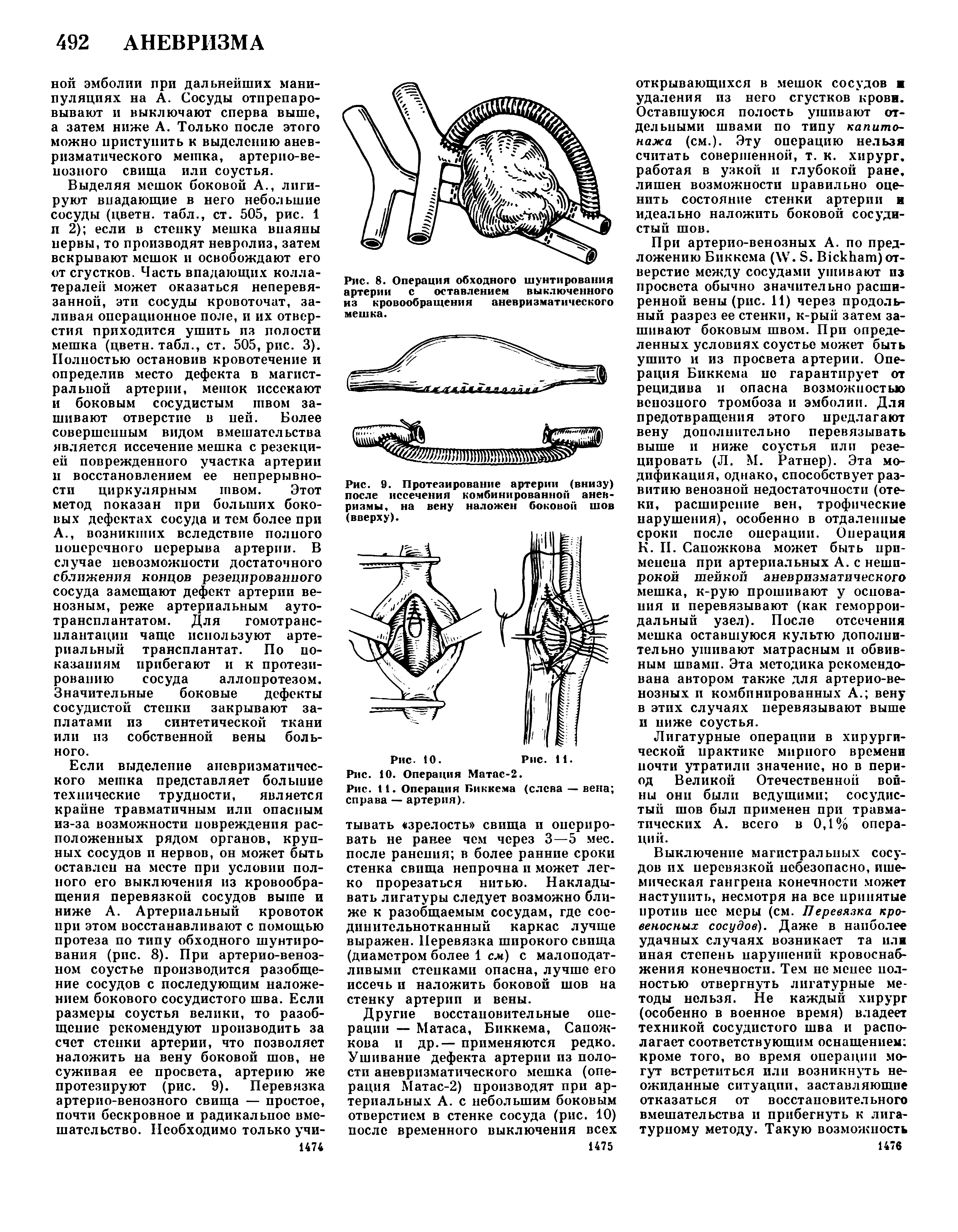 Рис. 9. Протезирование артерии (внизу) после иссечения комбинированной аневризмы, на вену наложен боковой шов (вверху).