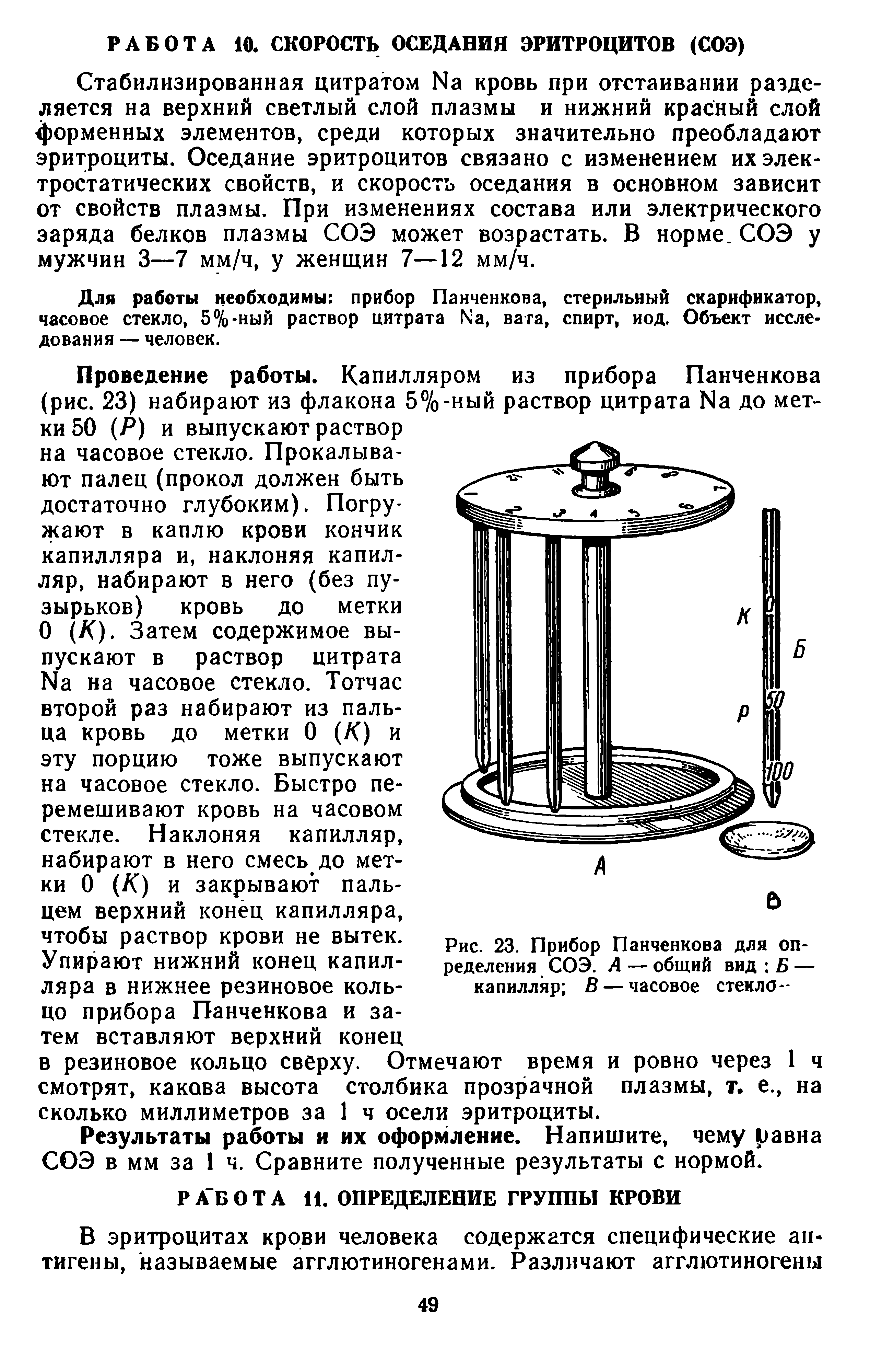 Рис. 23. Прибор Панченкова для определения СОЭ. А — общий вид Б — капилляр В — часовое стекла -...