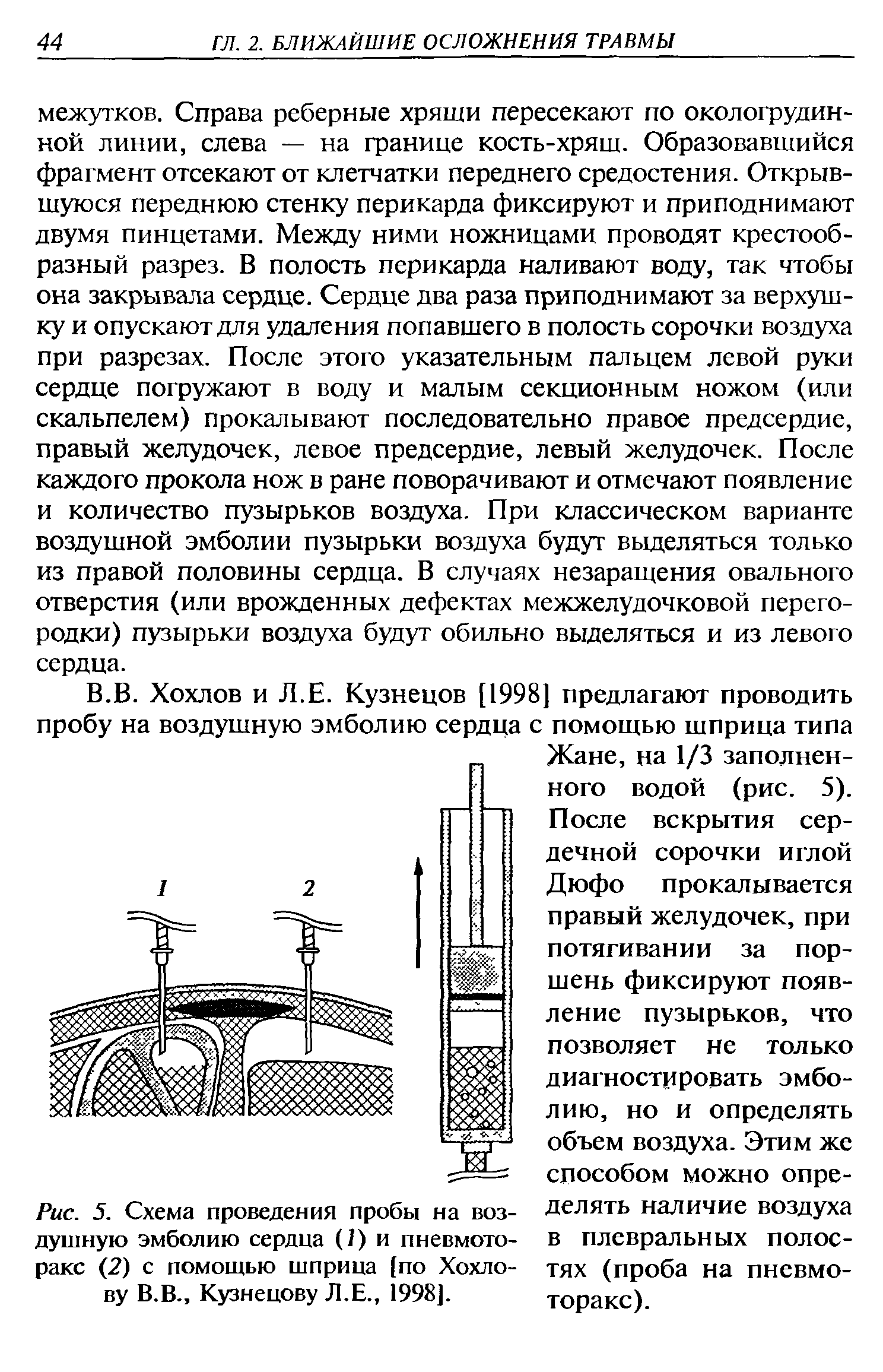 Рис. 5. Схема проведения пробы на воздушную эмболию сердца (1) и пневмоторакс (2) с помощью шприца [по Хохлову В.В., Кузнецову Л.Е., 1998].