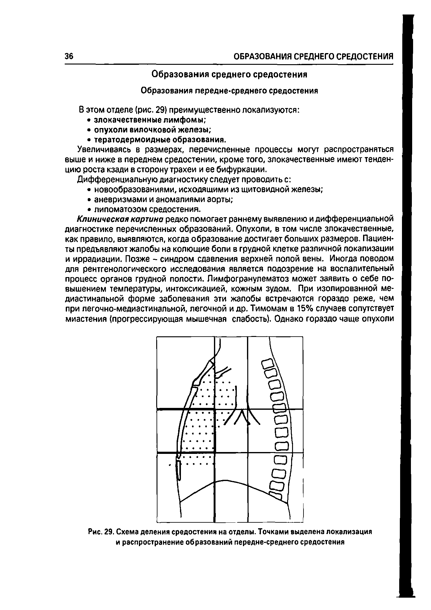 Рис. 29. Схема деления средостения на отделы. Точками выделена локализация и распространение образований передне-среднего средостения...