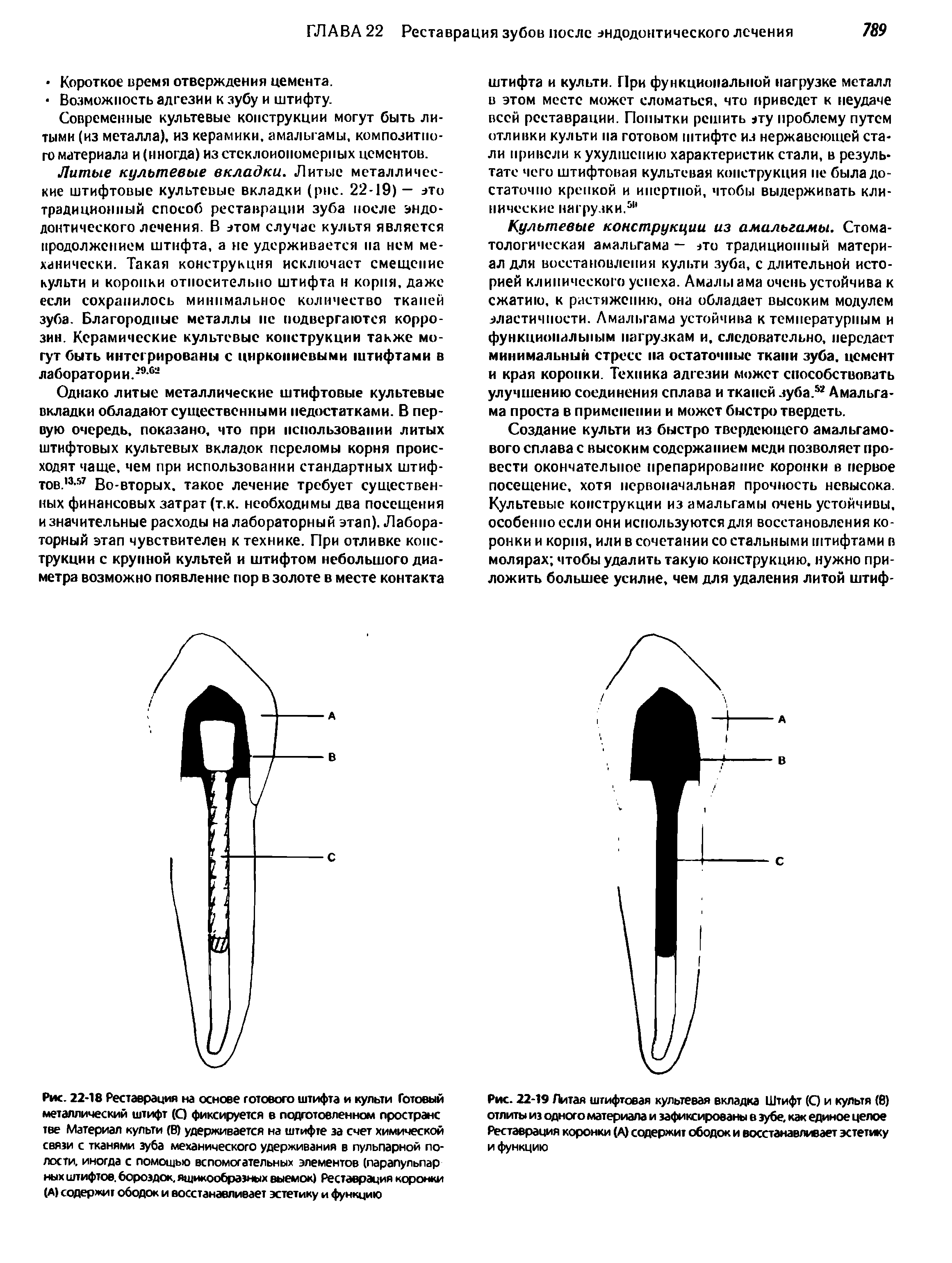 Рис. 22-19 Литая штифтовая культевая вкладка Штифт (О и культя (в) отлиты из одного материала и зафиксированы в зубе, как единое целое Реставрация коронки (А) содержит ободок и восстанавливает эстетику и функцию...