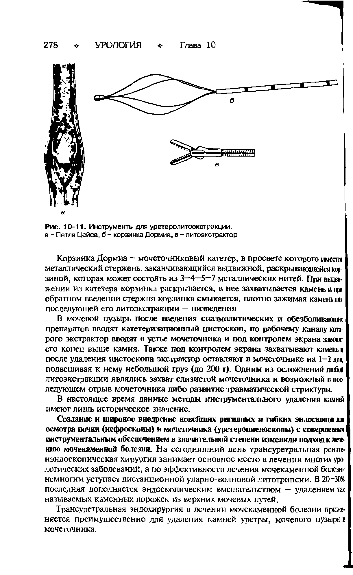 Рис. 10-11. Инструменты для уретеролитоэкстракции. а - Петля Цейса, б - корзинка Дормиа, в - литоэкстрактор...