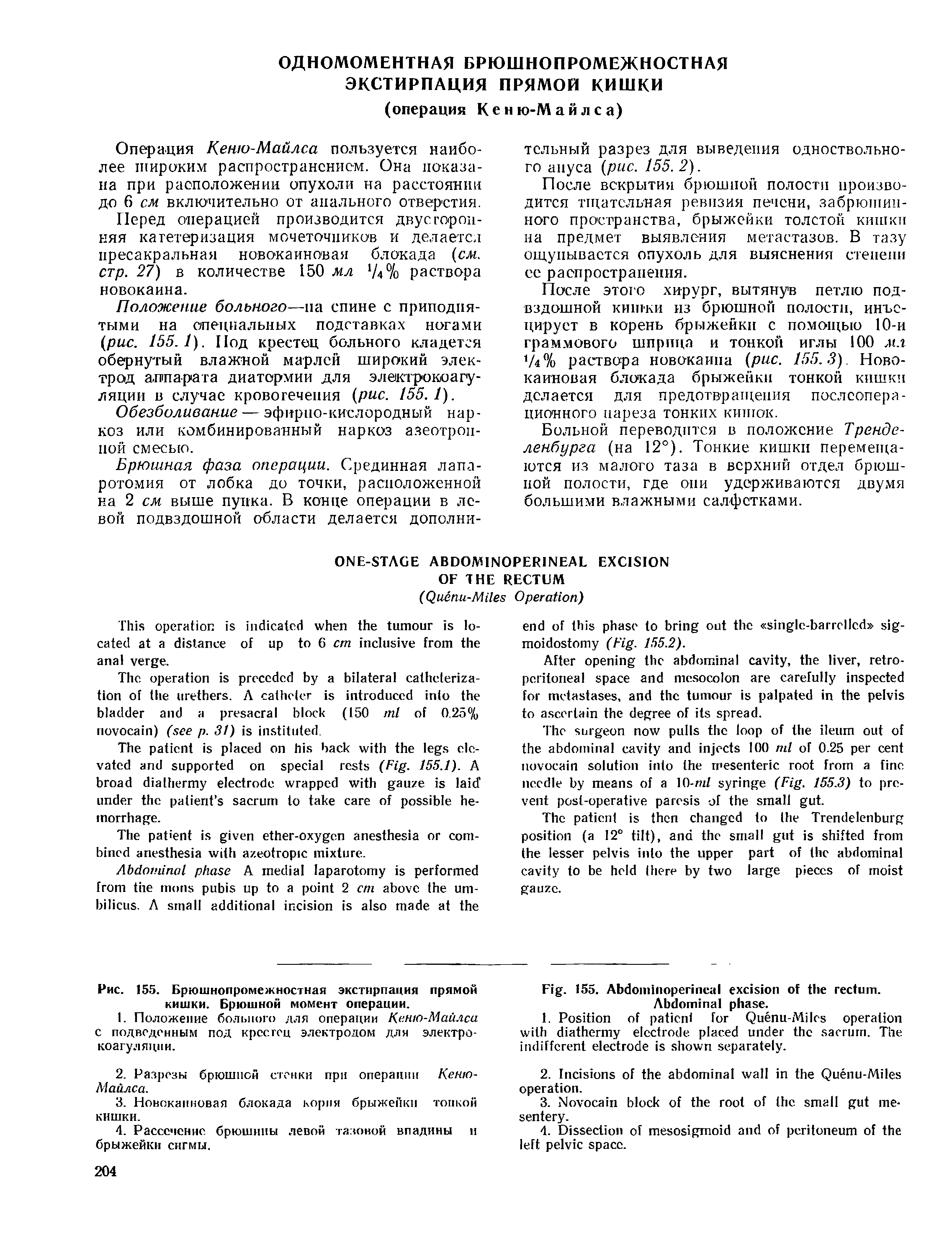 Рис. 155. Брюшнопромежностная экстирпация прямой кишки. Брюшной момент операции.