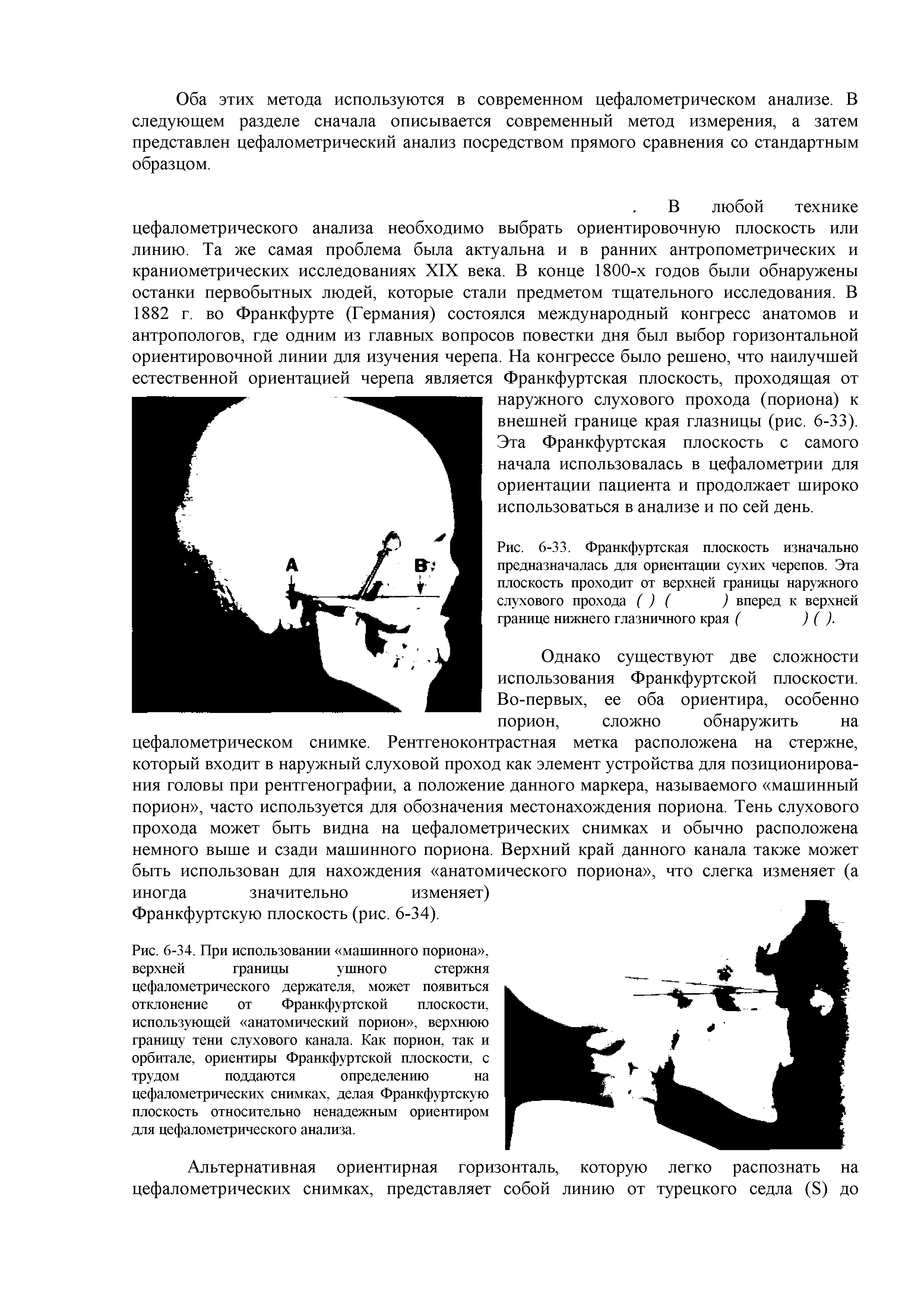 Рис. 6-33. Франкфуртская плоскость изначально предназначалась для ориентации сухих черепов. Эта плоскость проходит от верхней границы наружного слухового прохода ( ) ( ) вперед к верхней...