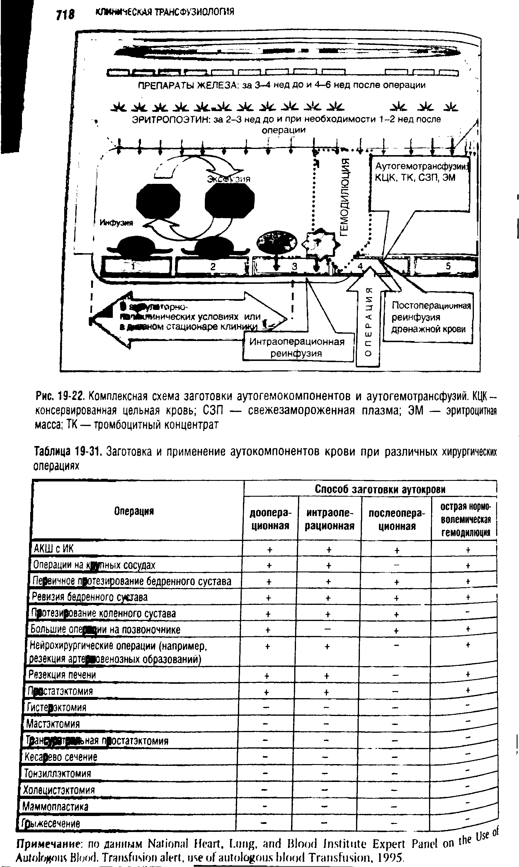 Рис. 19-22. Комплексная схема заготовки аутогемокомпонентов и аутогемотрансфузий. КЦК — консервированная цельная кровь СЗП — свежезамороженная плазма ЭМ — эритроцитная масса ТК — тромбоцитный концентрат...