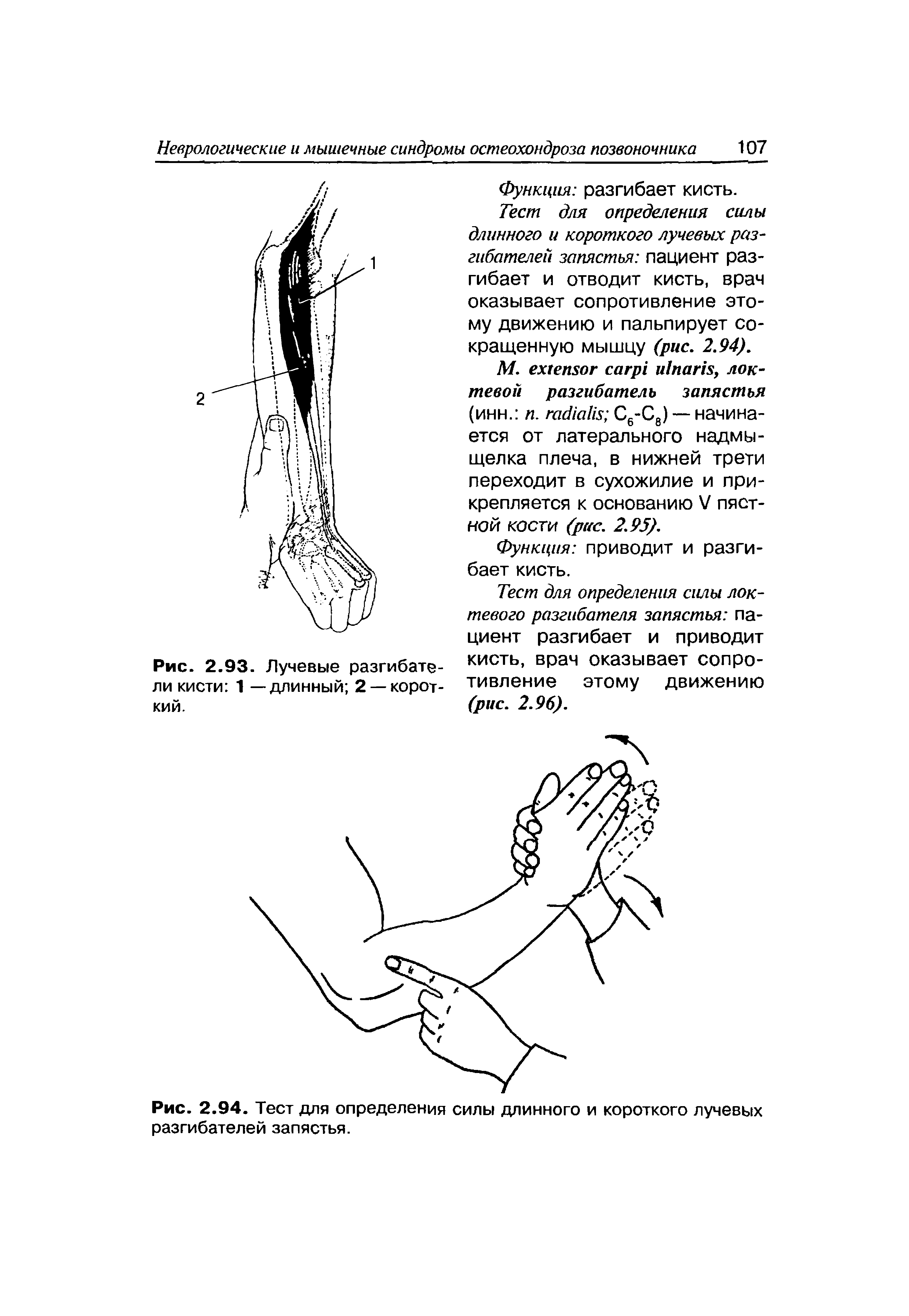 Рис. 2.94. Тест для определения силы длинного и короткого лучевых разгибателей запястья.