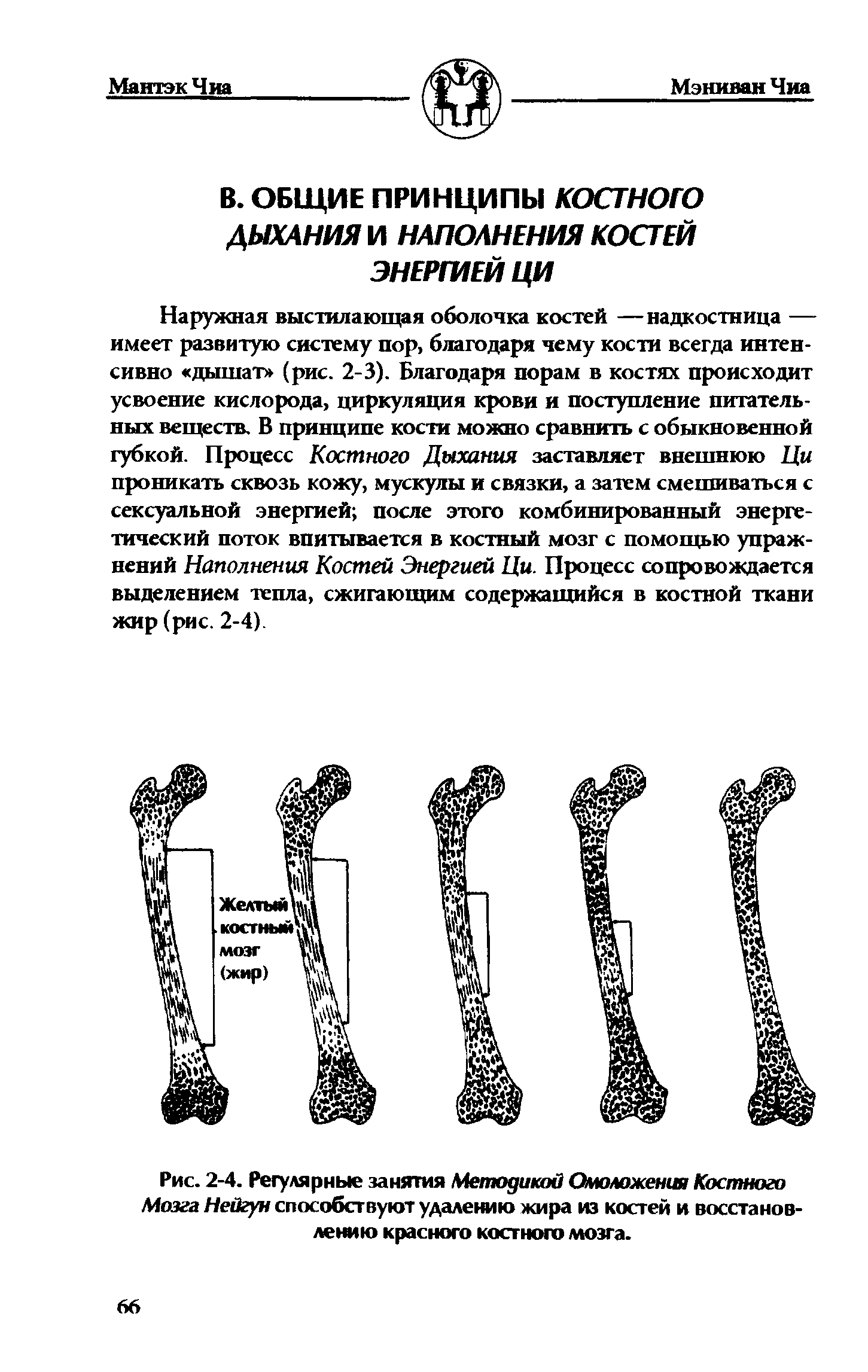 Рис. 2-4. Регулярные занятия Методикой Омоложения Костного Мозга Нейгун способствуют удалению жира из костей и восстановлению красного костного мозга.