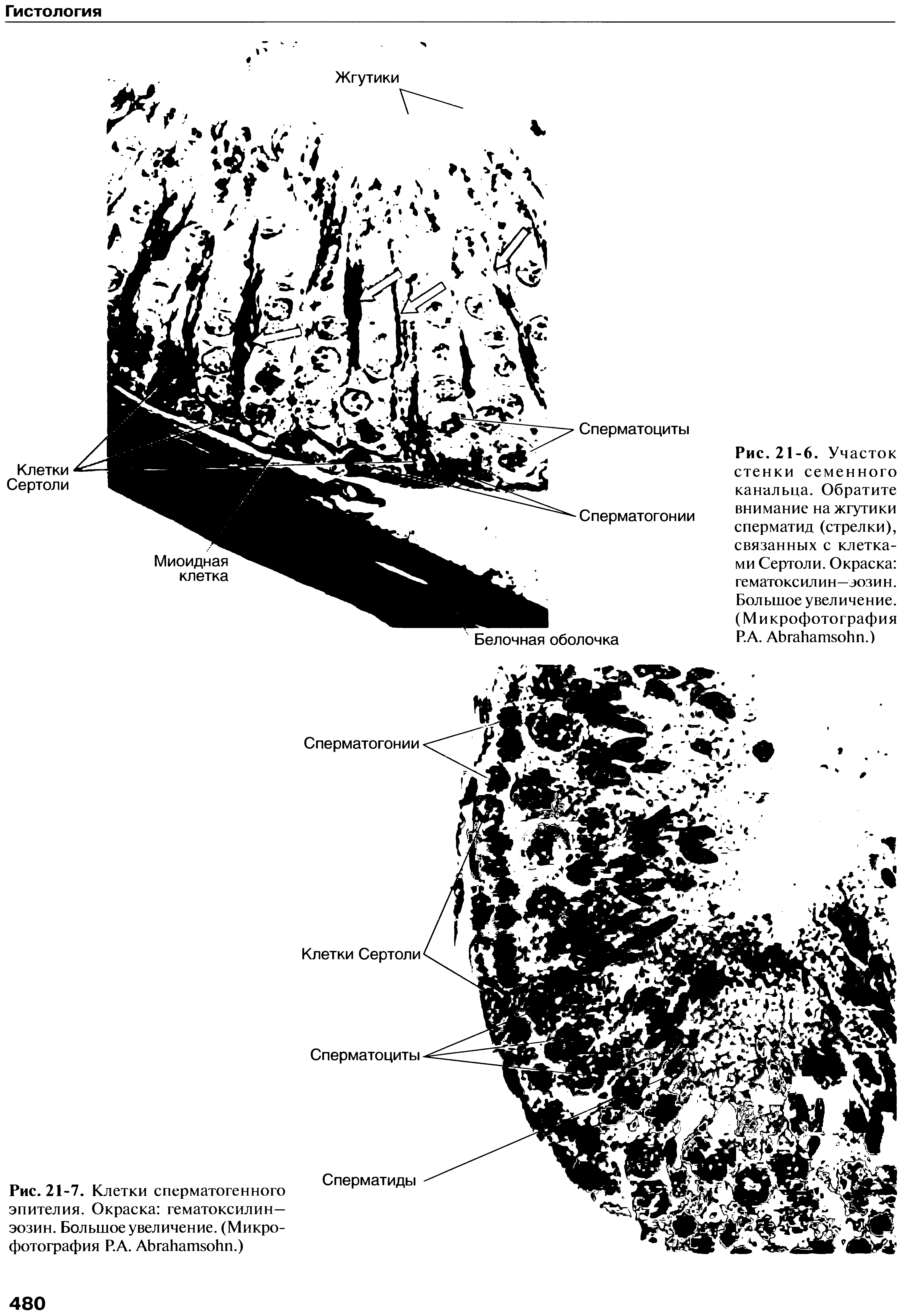 Рис.21-6. Участок стенки семенного канальца. Обратите внимание на жгутики сперматид (стрелки), связанных с клетками Сертоли. Окраска гематоксилин—эозин. Большое увеличение. (Микрофотография Р.А. АЬгаИаи оИп.)...