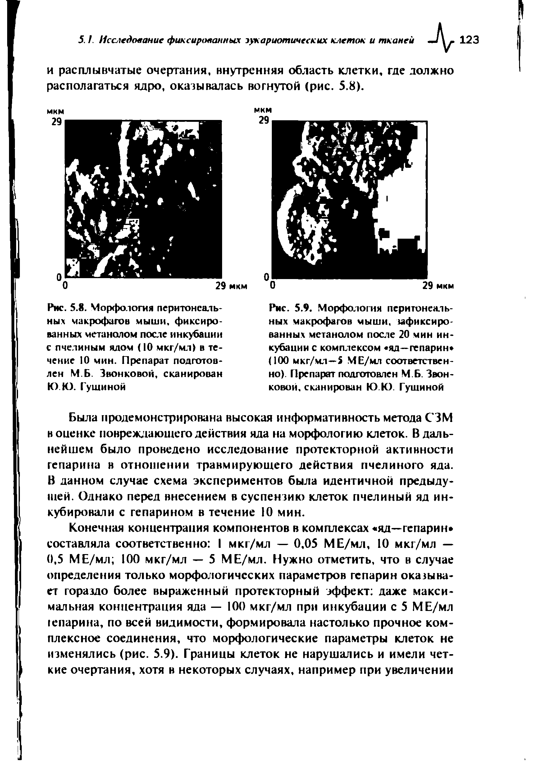 Рис. 5.8. Морфология перитонеальных макрофагов мыши, фиксированных метанолом после инкубации с пчелиным ялом (10 мкг/мл) в течение 10 мин. Препарат подготовлен М.Б. Звонковой, сканирован Ю.Ю. Гущиной...