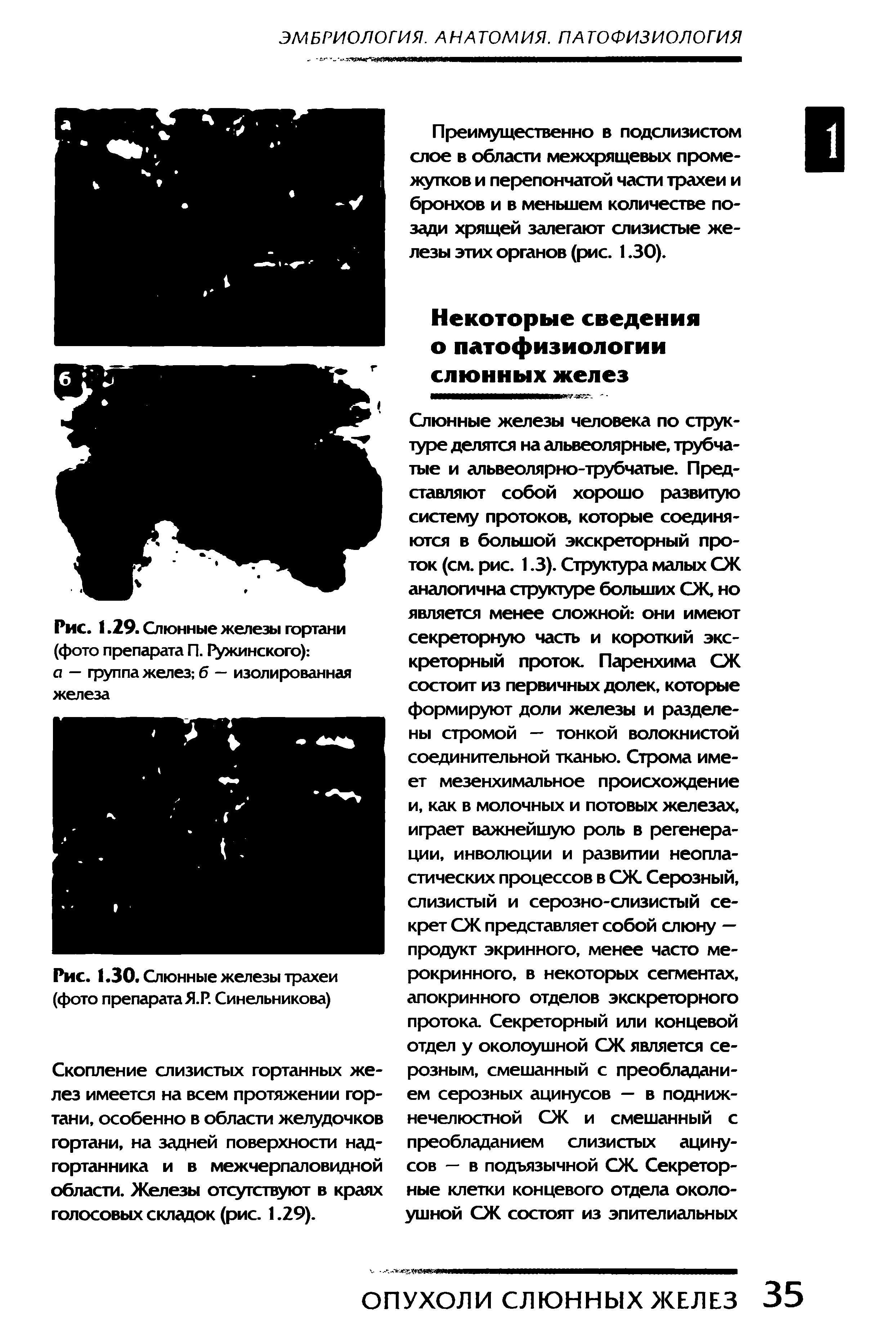 Рис. 1.29. Слюнные железы гортани (фото препарата П. Ружинского) а — группа желез б — изолированная железа...