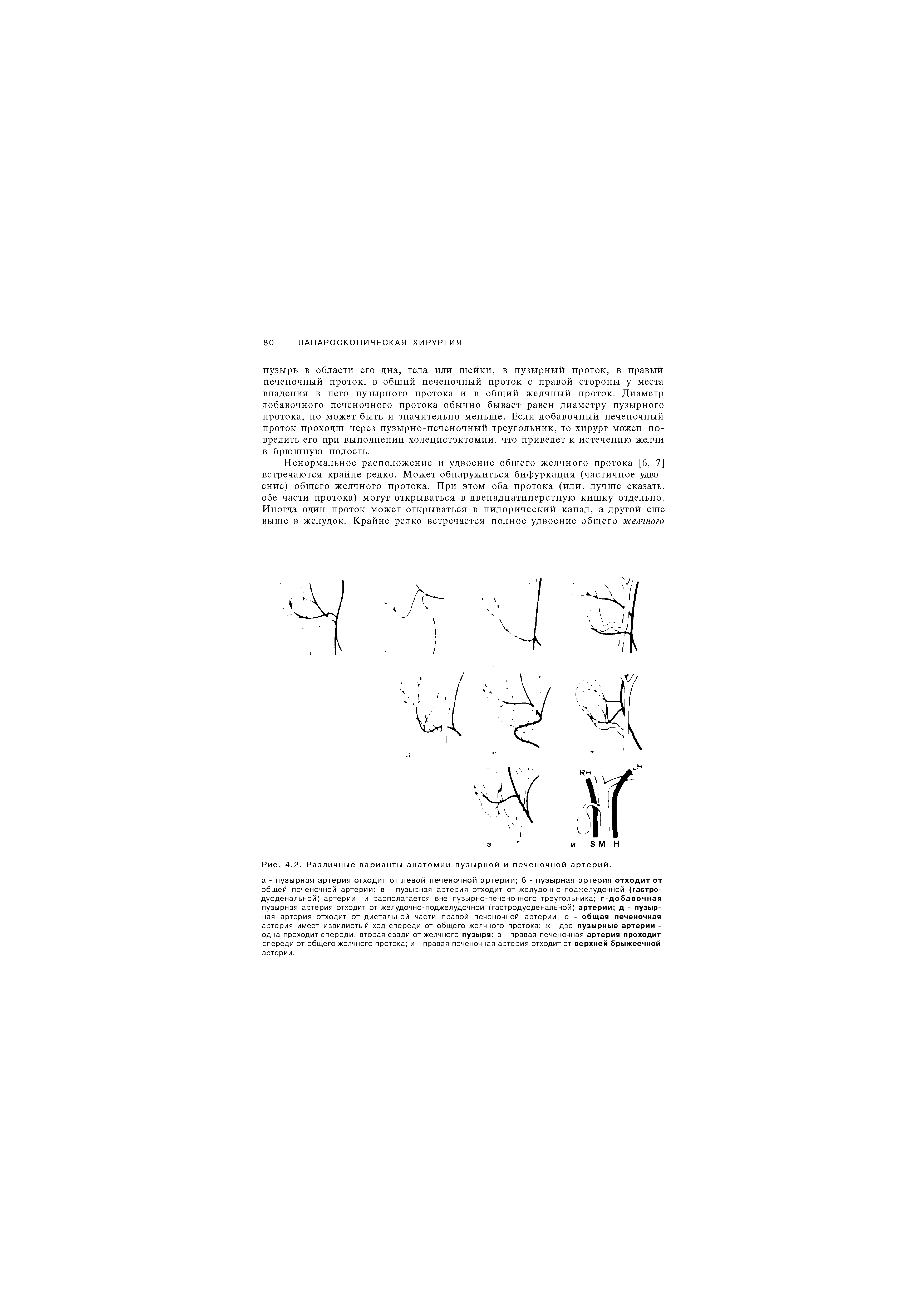 Рис. 4.2. Различные варианты анатомии пузырной и печеночной артерий.
