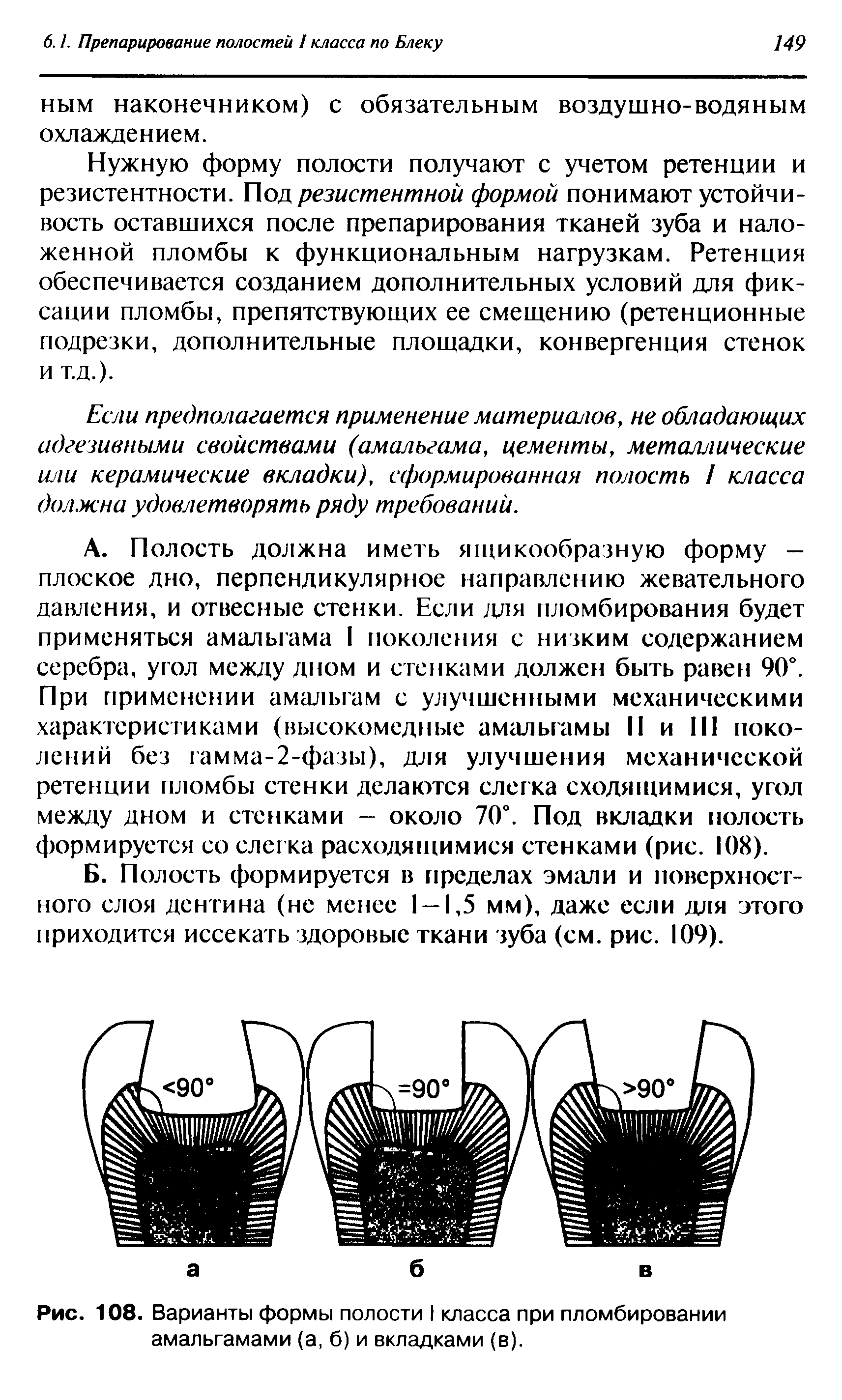 Рис. 108. Варианты формы полости I класса при пломбировании амальгамами (а, б) и вкладками (в).