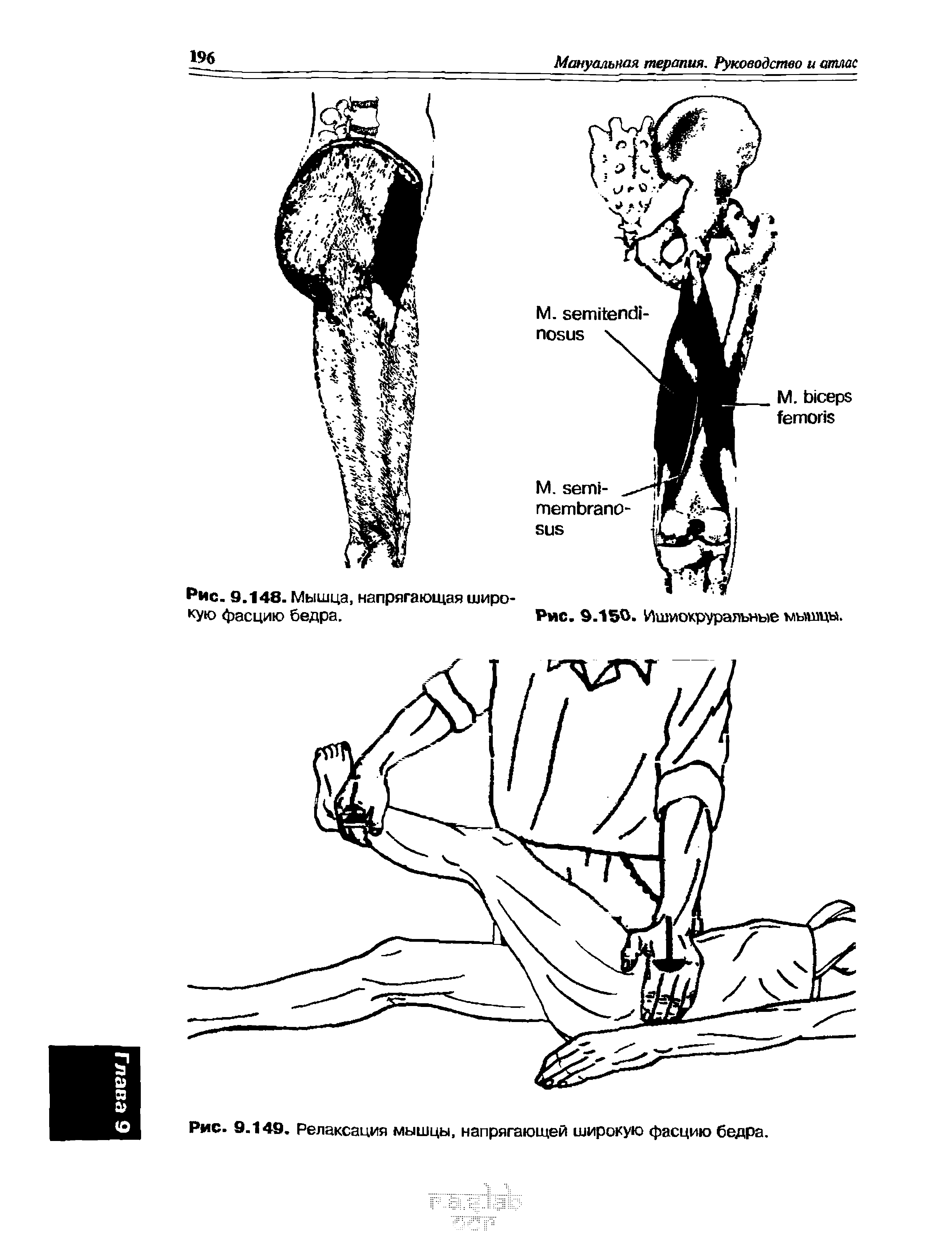 Рис. 9.149. Релаксация мышцы, напрягающей широкую фасцию бедра.