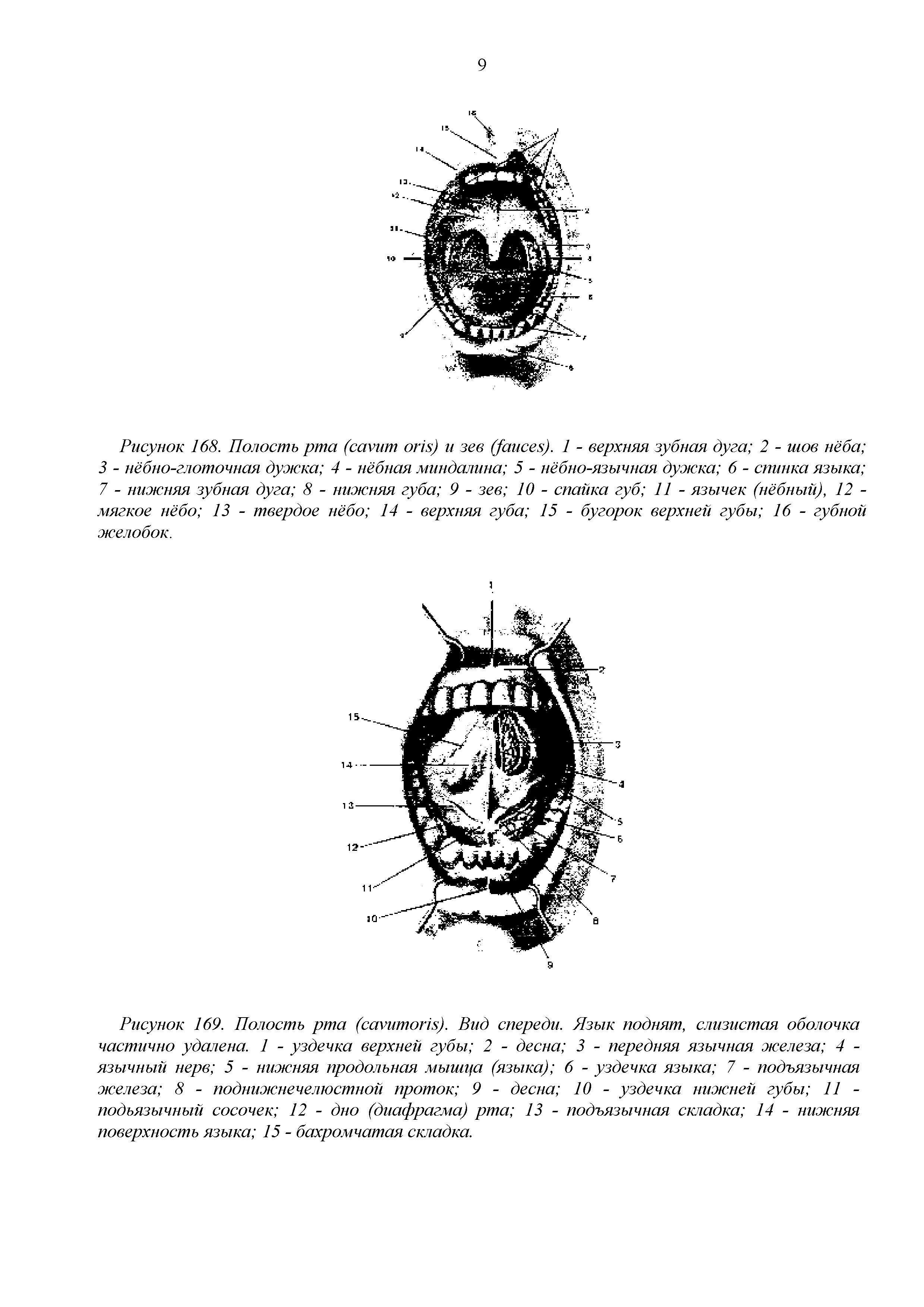 Рисунок 169. Полость рта (сагитон.р. Вид спереди. Язык поднят, слизистая оболочка частично удалена. 1 - уздечка верхней губы 2 - десна 3 - передняя язычная железа 4 -язычный нерв 5 - нижняя продольная мышца (языка) 6 - уздечка языка 7 - подъязычная железа 8 - поднижнечелюстной проток 9 - десна 10 - уздечка нижней губы 11 -подъязычный сосочек 12 - дно (диафрагма) рта 13 - подъязычная складка 14 - нижняя поверхность языка 15 - бахромчатая складка.