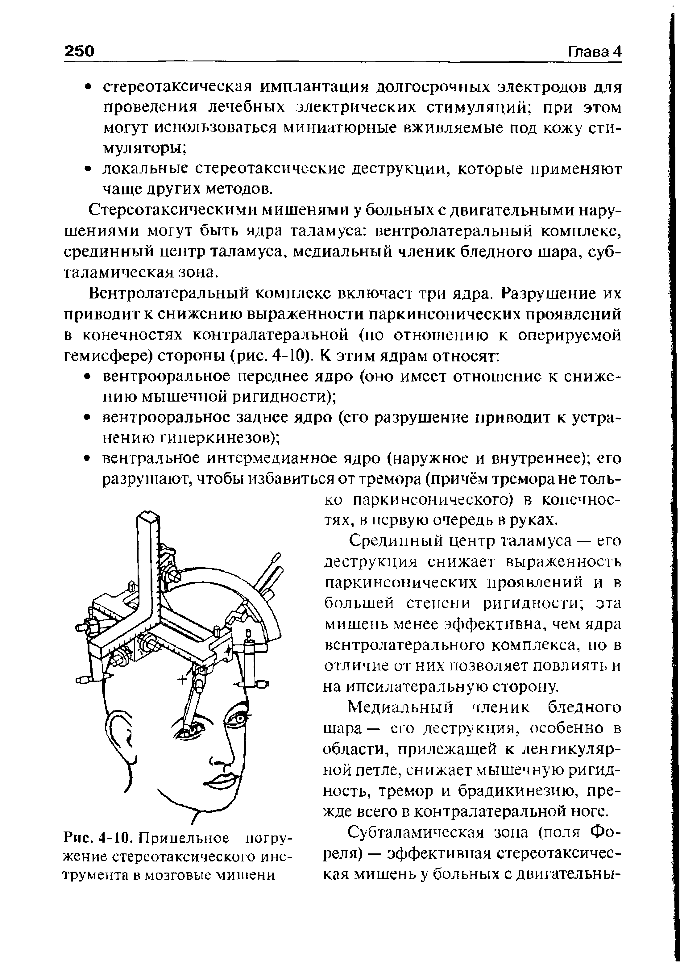 Рис. 4-10. Прицельное погружение стереотаксического инструмента в мозговые мишени...