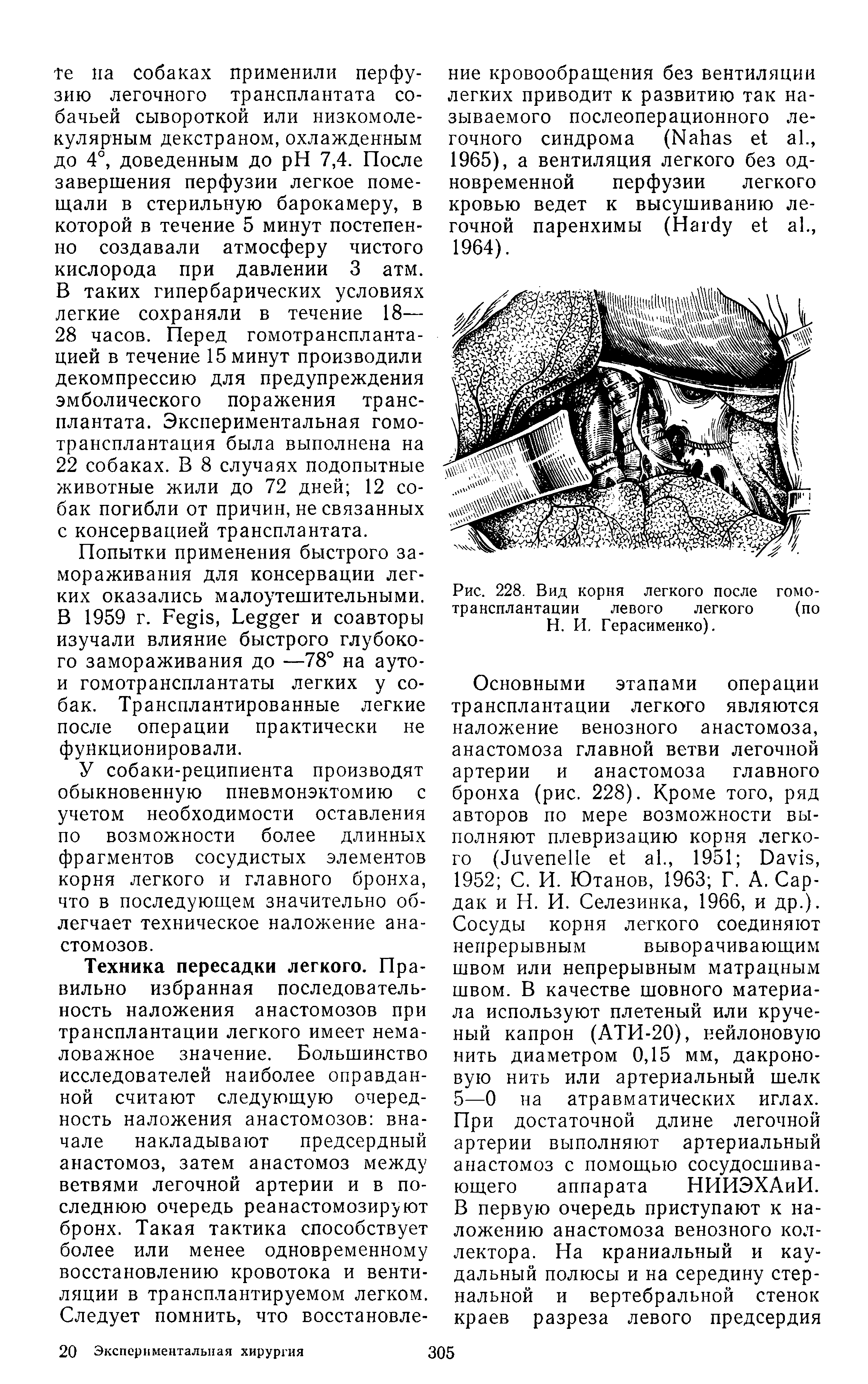 Рис. 228. Вид корня легкого после гомотрансплантации левого легкого (по...