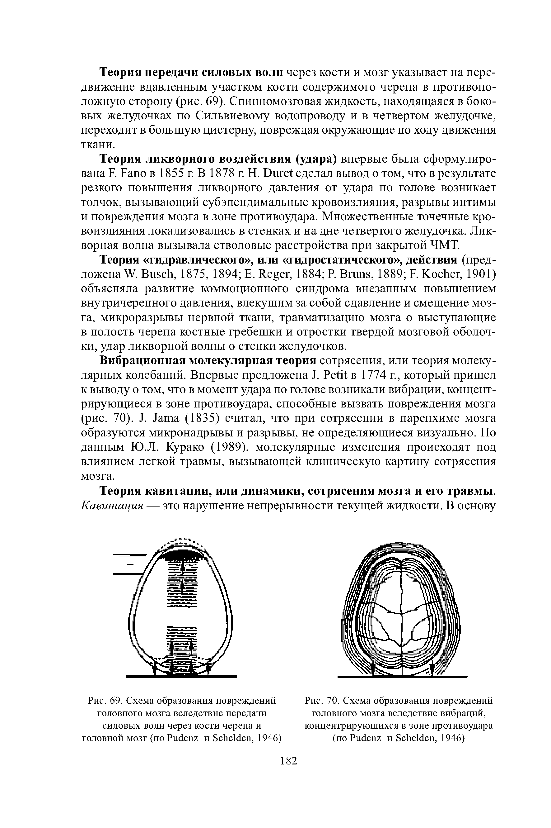 Рис. 70. Схема образования повреждений головного мозга вследствие вибраций, концентрирующихся в зоне противоудара (по P и S , 1946)...