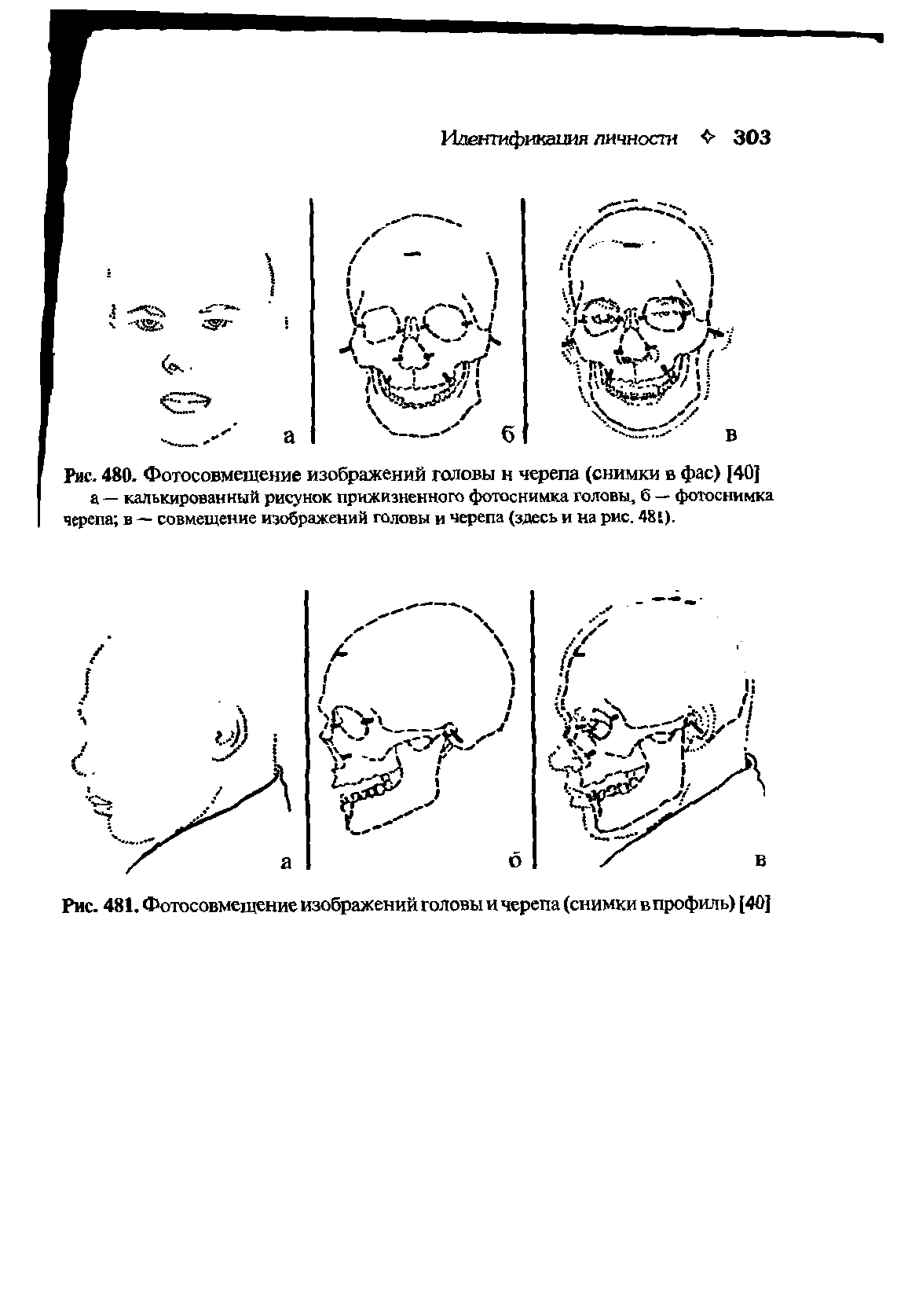 Рис. 481. Фотосовмещение изображений головы и черепа (снимки впрофиль) [40]...