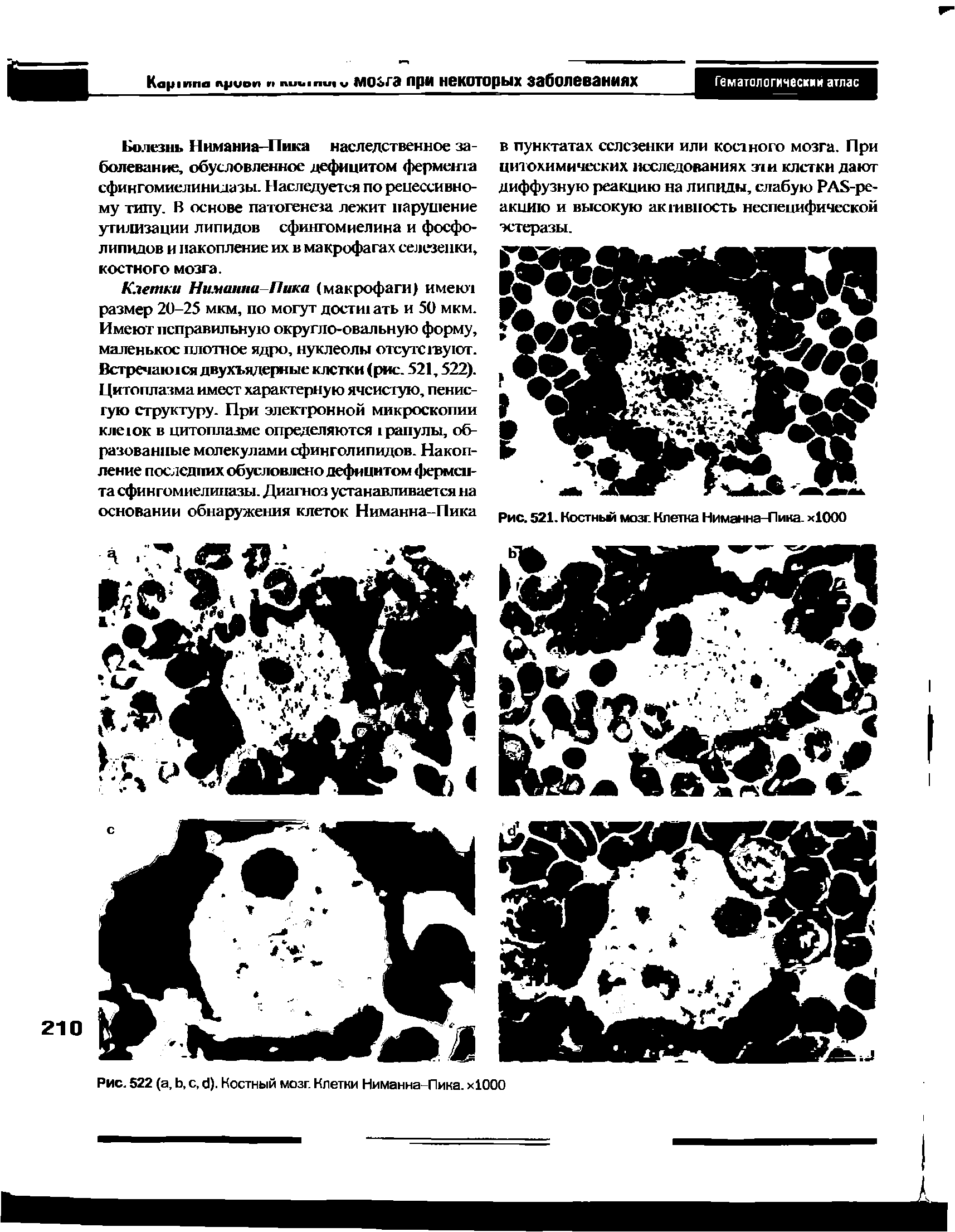 Рис. 521. Костный мозг. Клетка Ниманна-Пика. х1000...